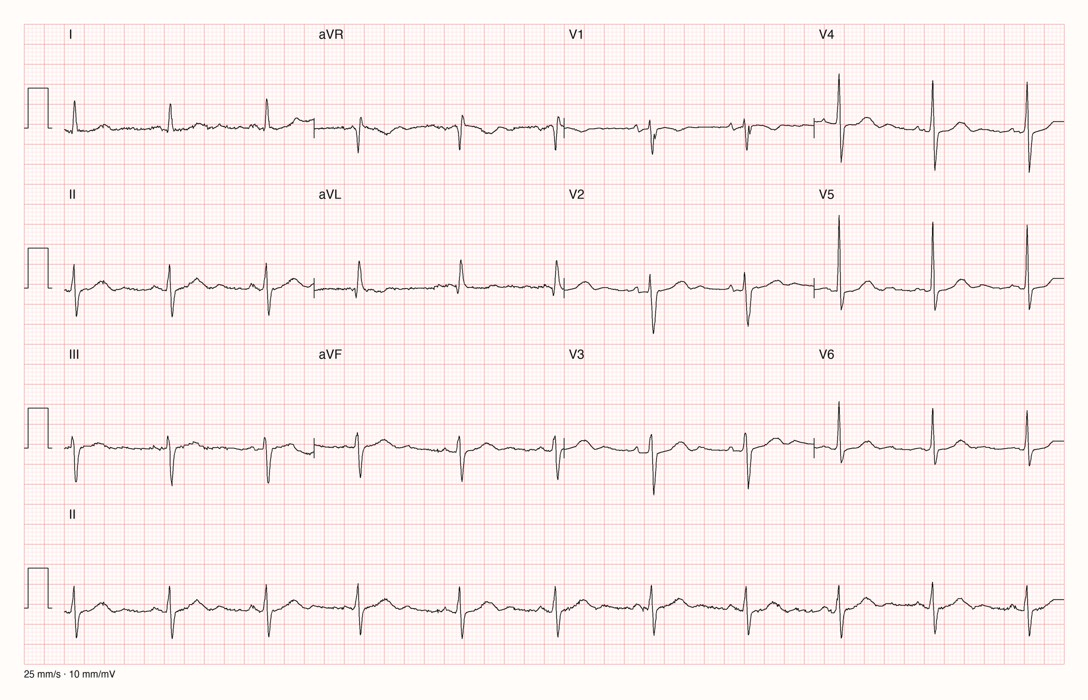12-Kanal-EKG 157; zur systematischen Befundung
