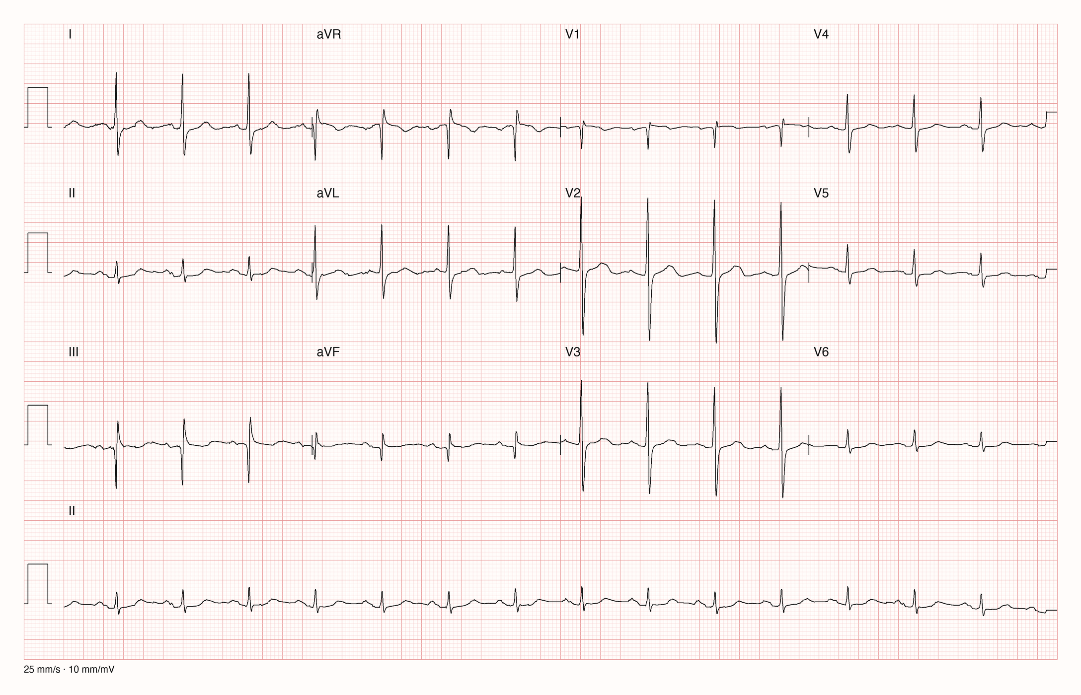 12-Kanal-EKG 1577; zur systematischen Befundung