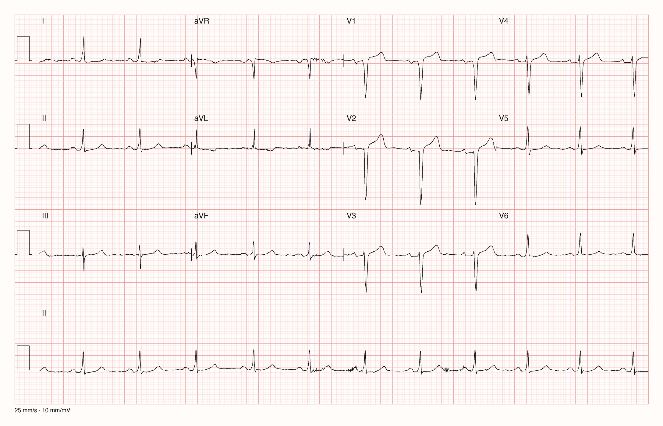 12-Kanal-EKG 15865; zur systematischen Befundung