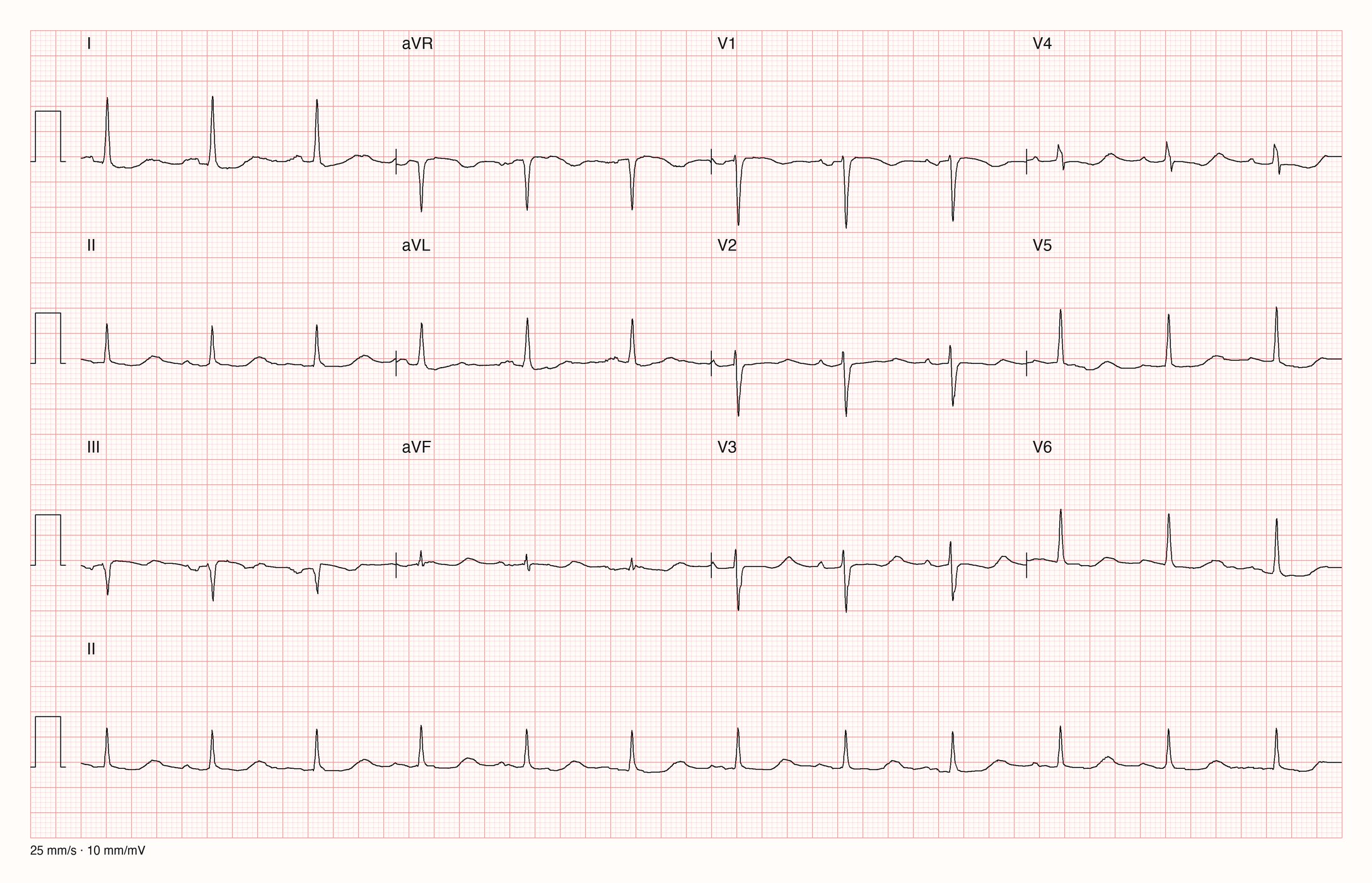 12-Kanal-EKG 16101; zur systematischen Befundung