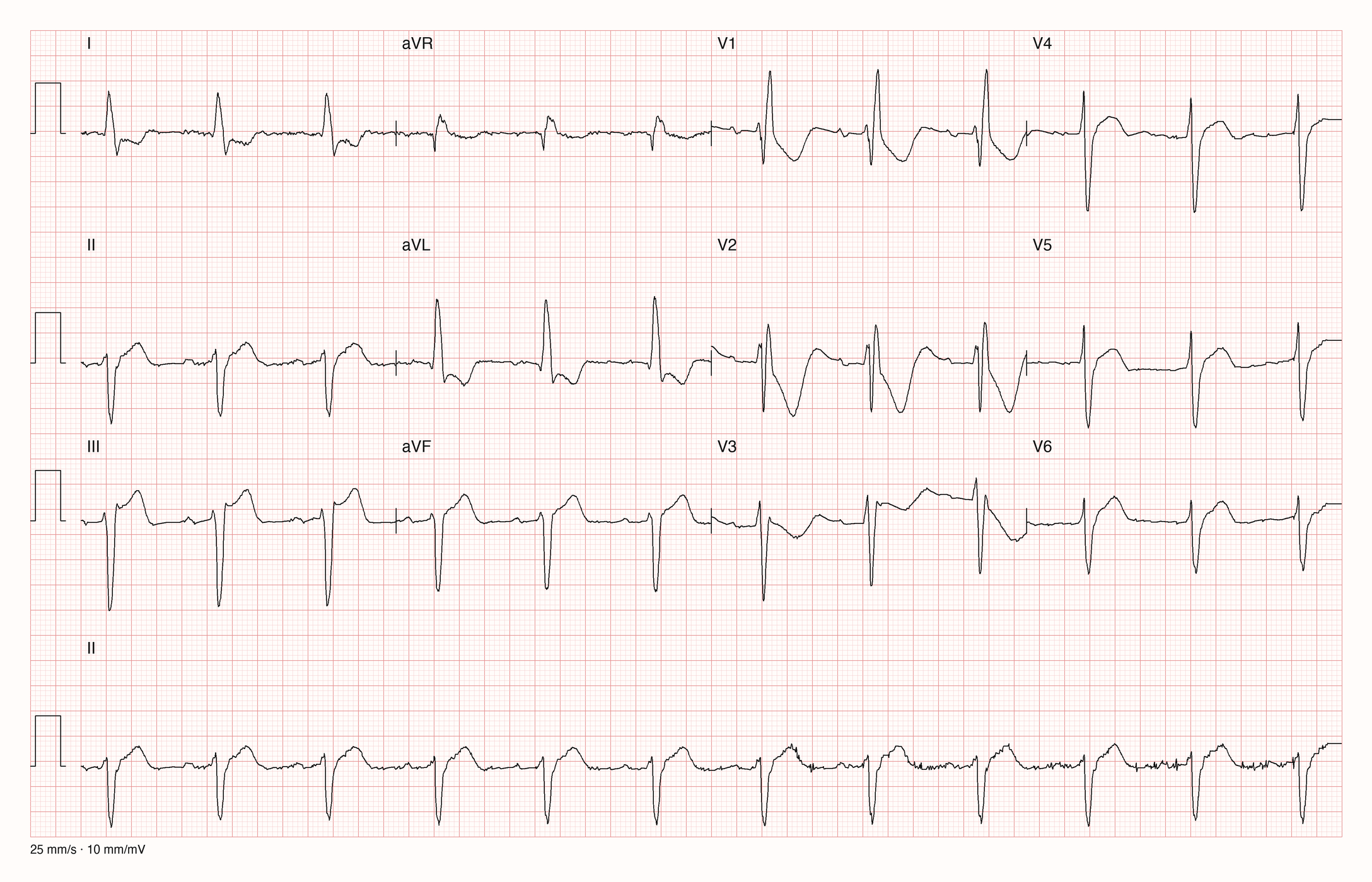 12-Kanal-EKG 16206; zur systematischen Befundung