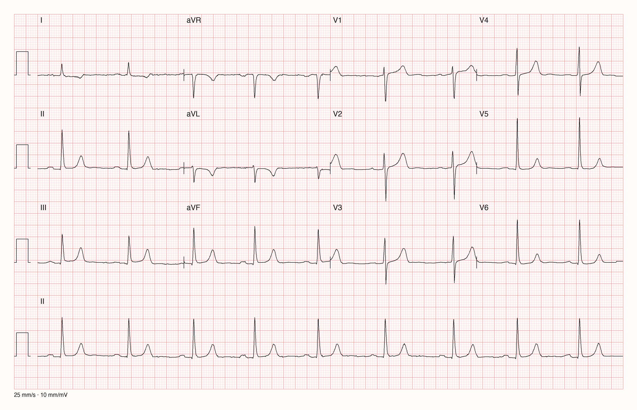 12-Kanal-EKG 167; zur systematischen Befundung