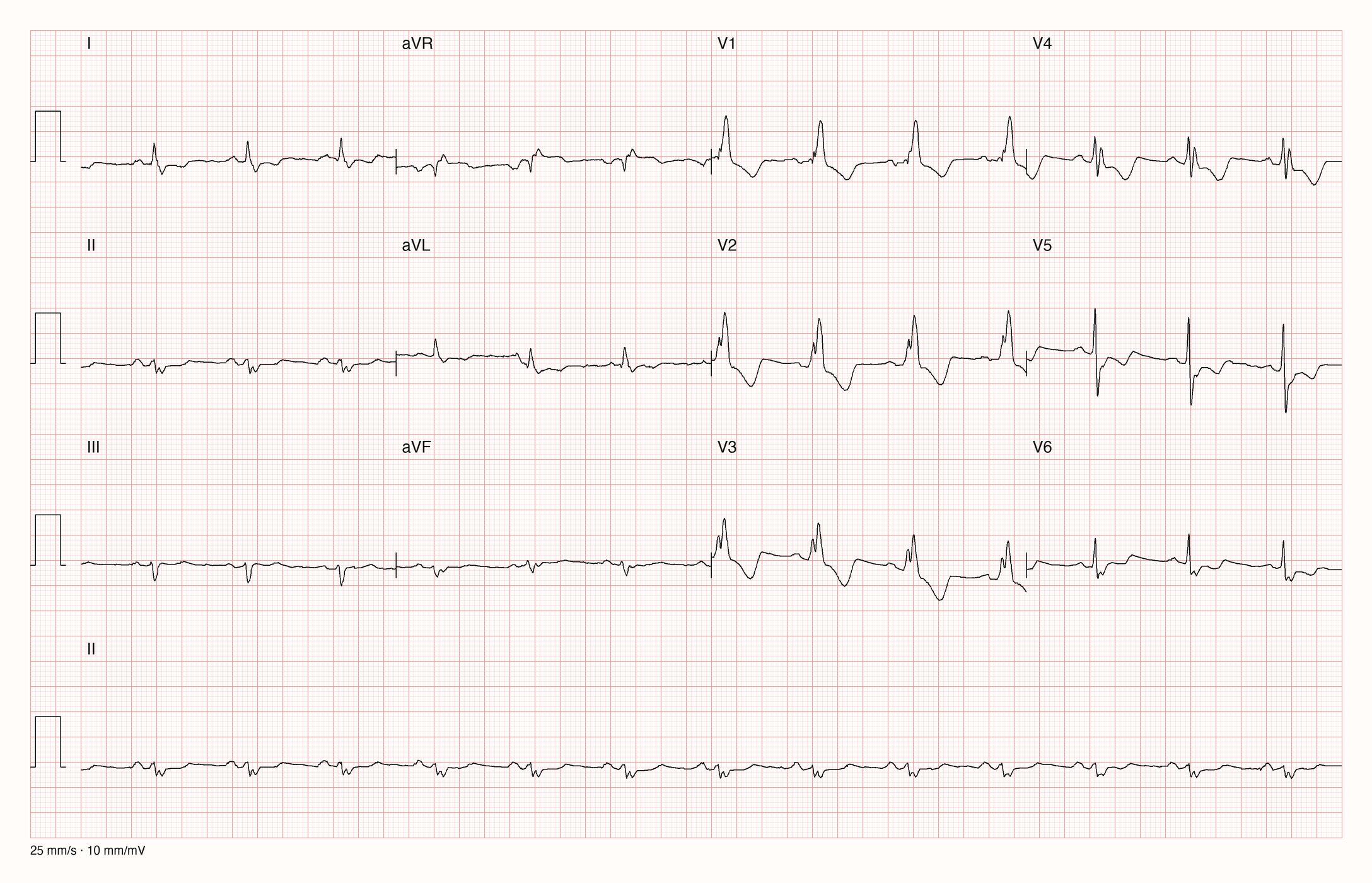 12-Kanal-EKG 172; zur systematischen Befundung