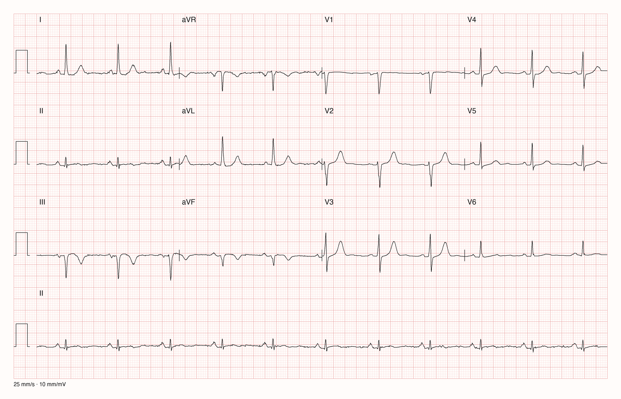 12-Kanal-EKG 1737; zur systematischen Befundung