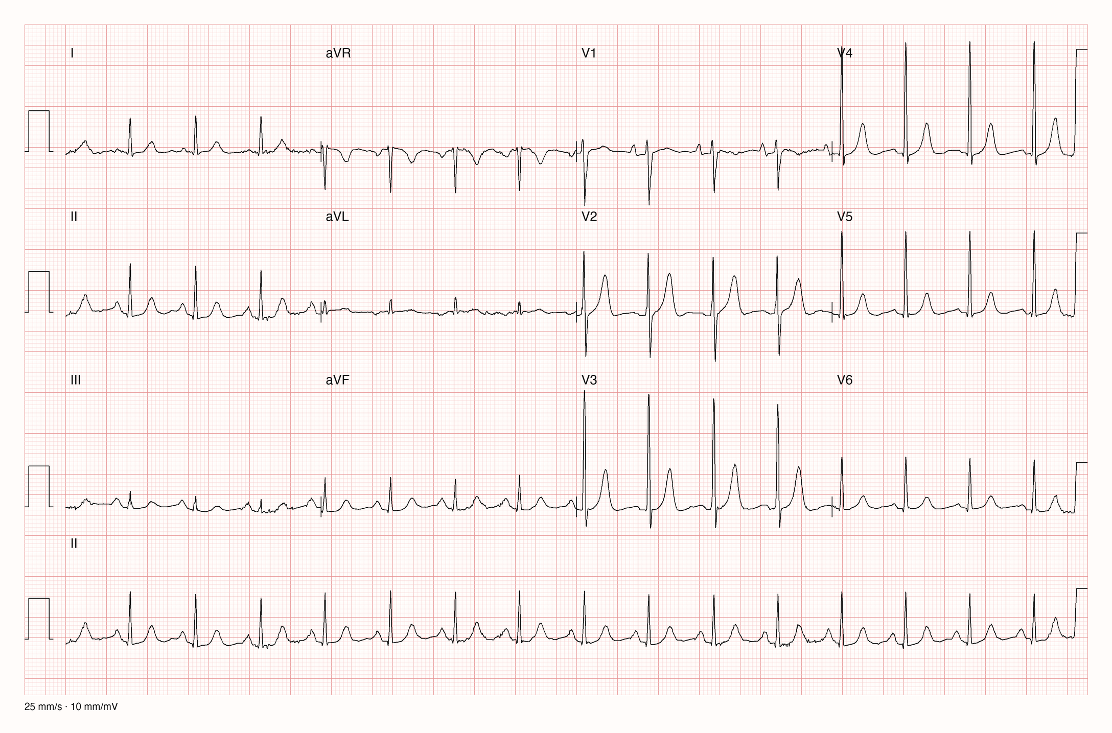 12-Kanal-EKG 1785; zur systematischen Befundung