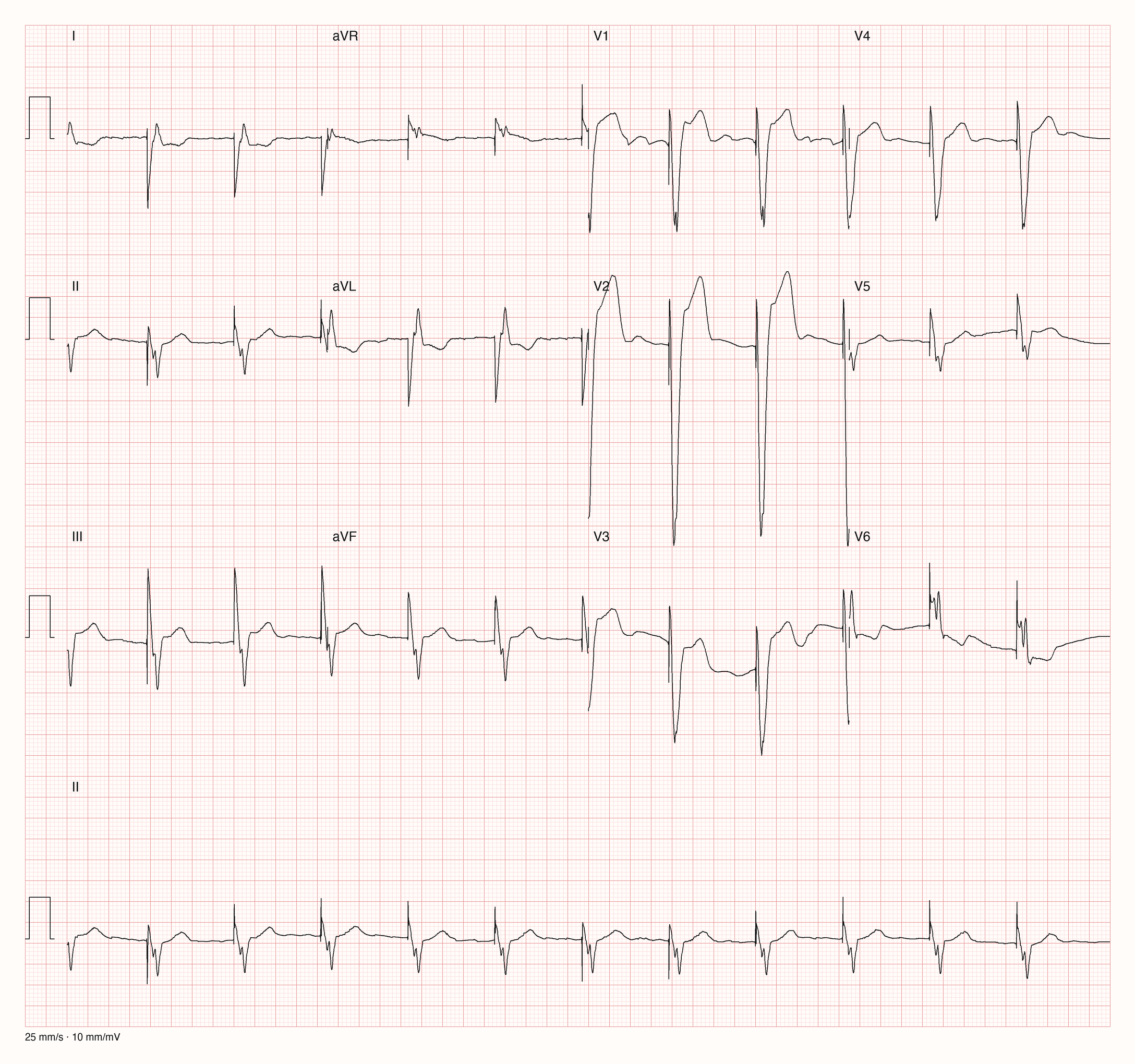 12-Kanal-EKG 2205; zur systematischen Befundung