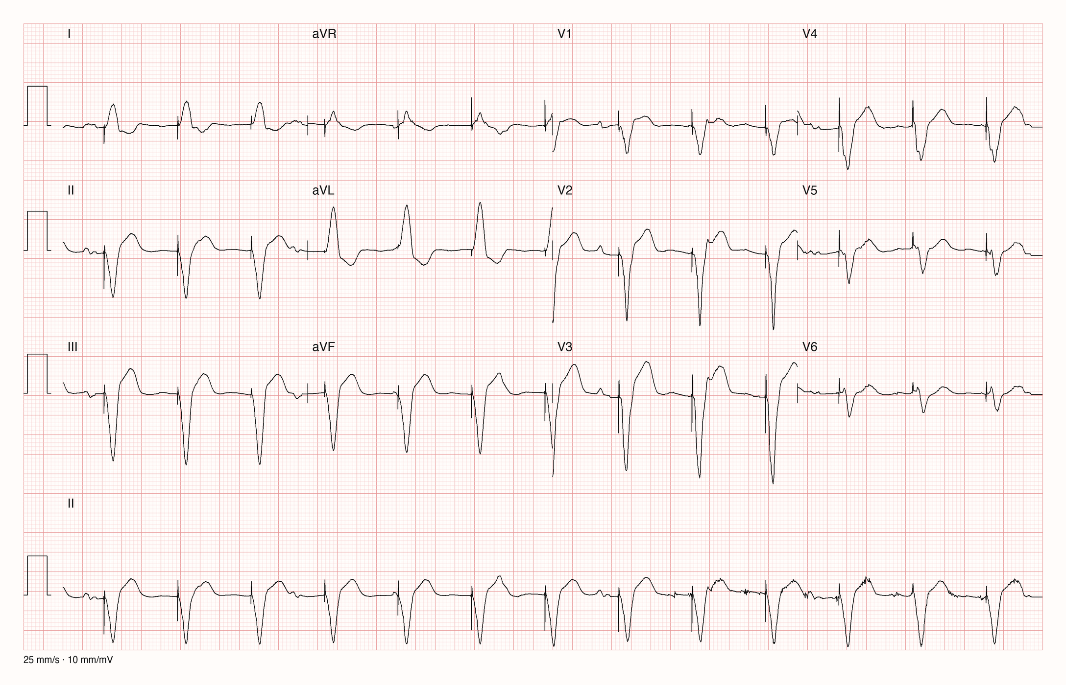 12-Kanal-EKG 2664; zur systematischen Befundung