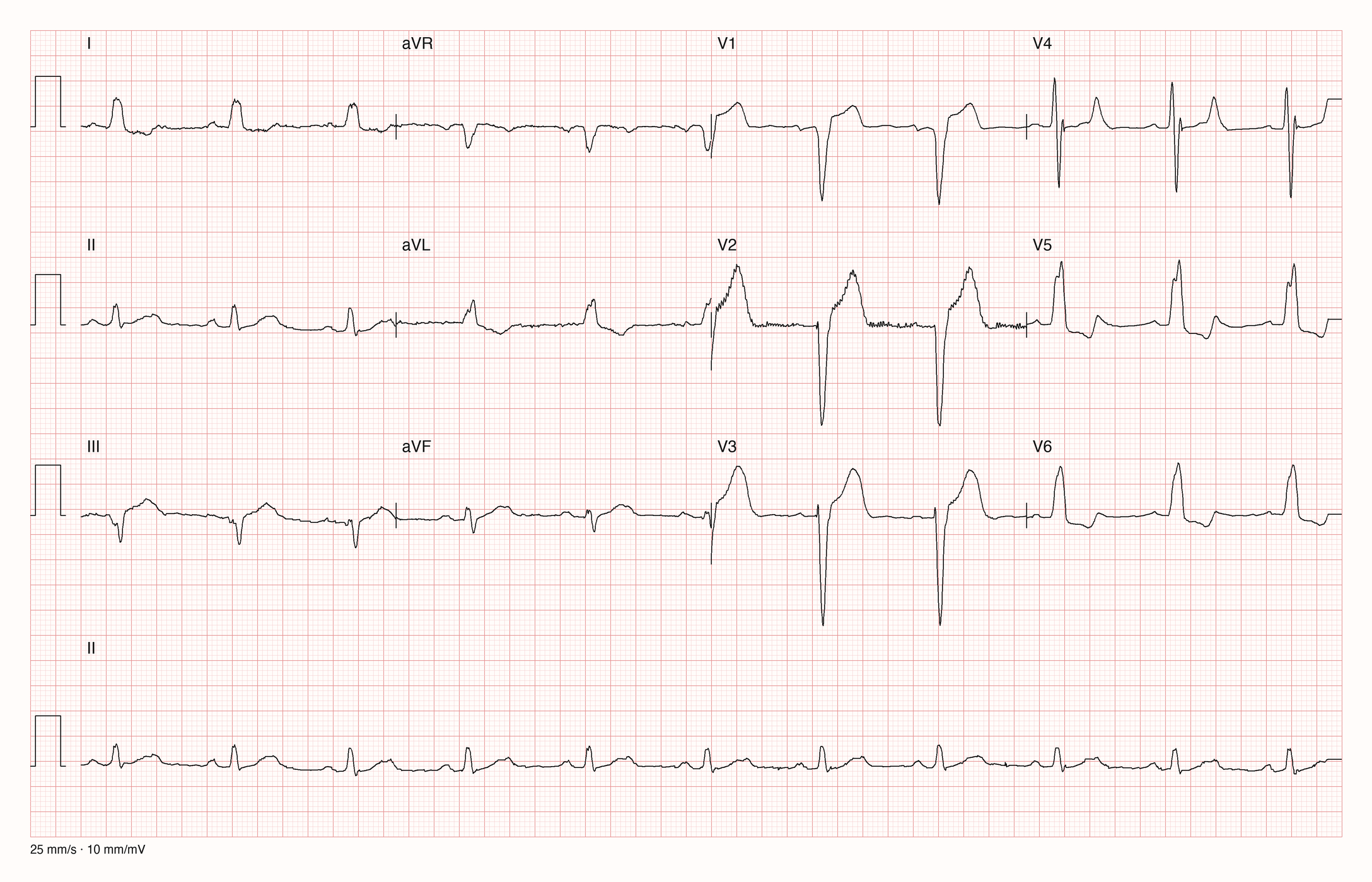 12-Kanal-EKG 2940; zur systematischen Befundung