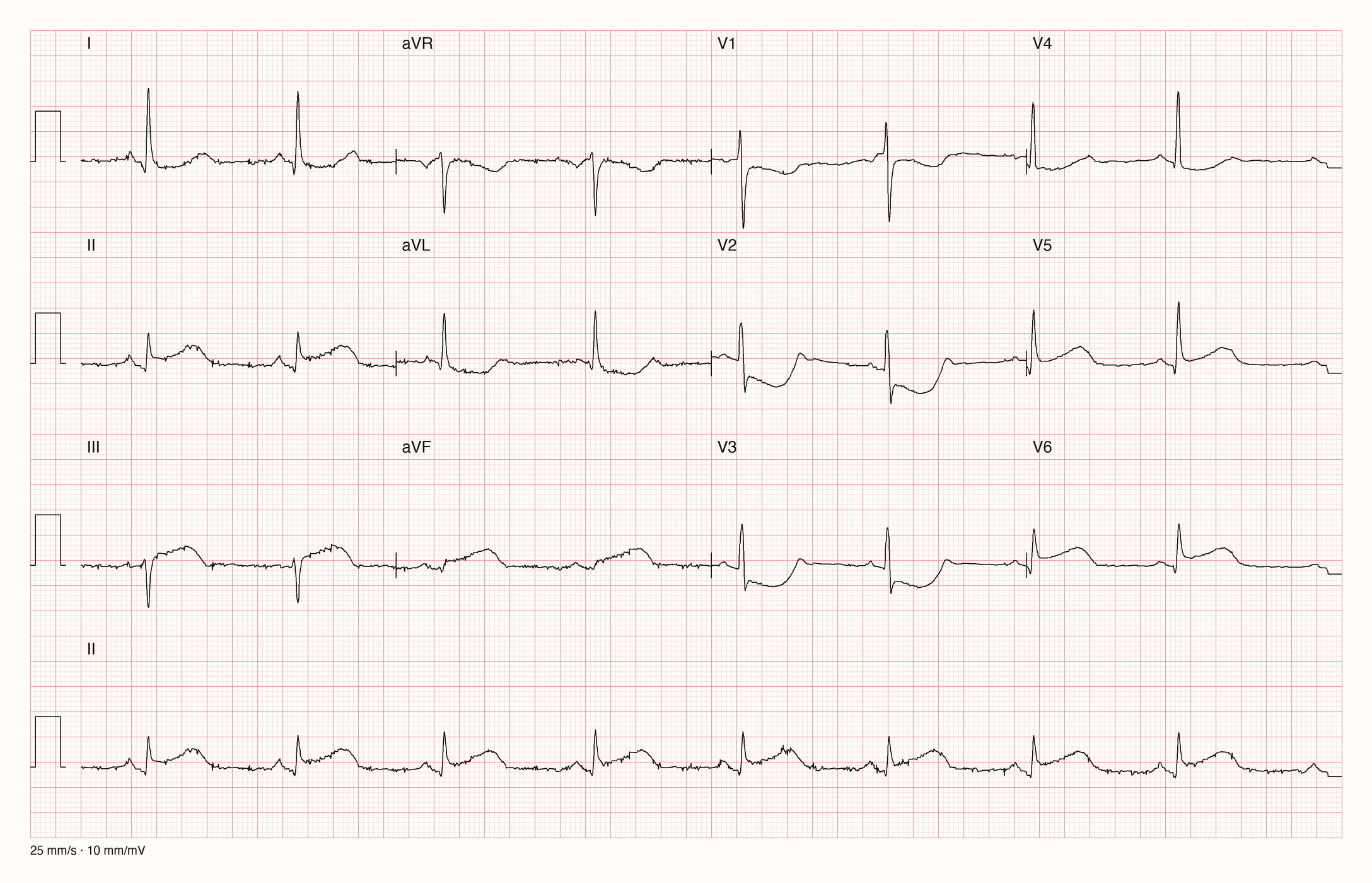 12-Kanal-EKG 2993; zur systematischen Befundung