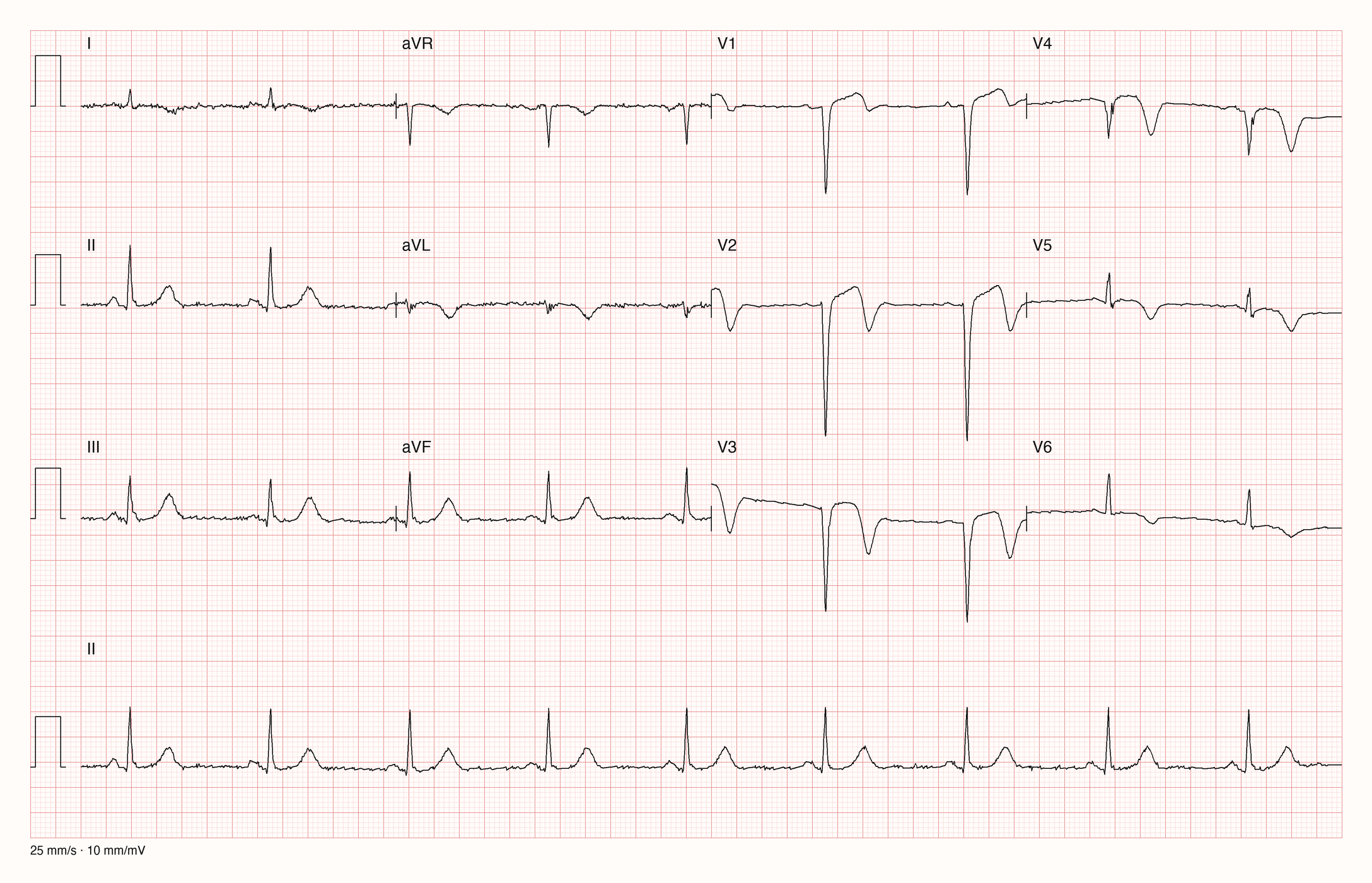 12-Kanal-EKG 3076; zur systematischen Befundung