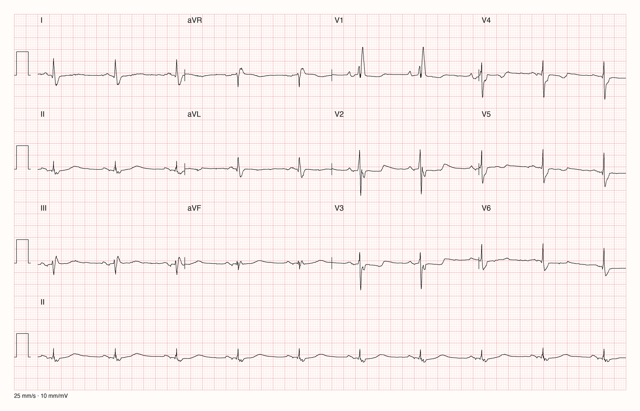 12-Kanal-EKG 3155; zur systematischen Befundung