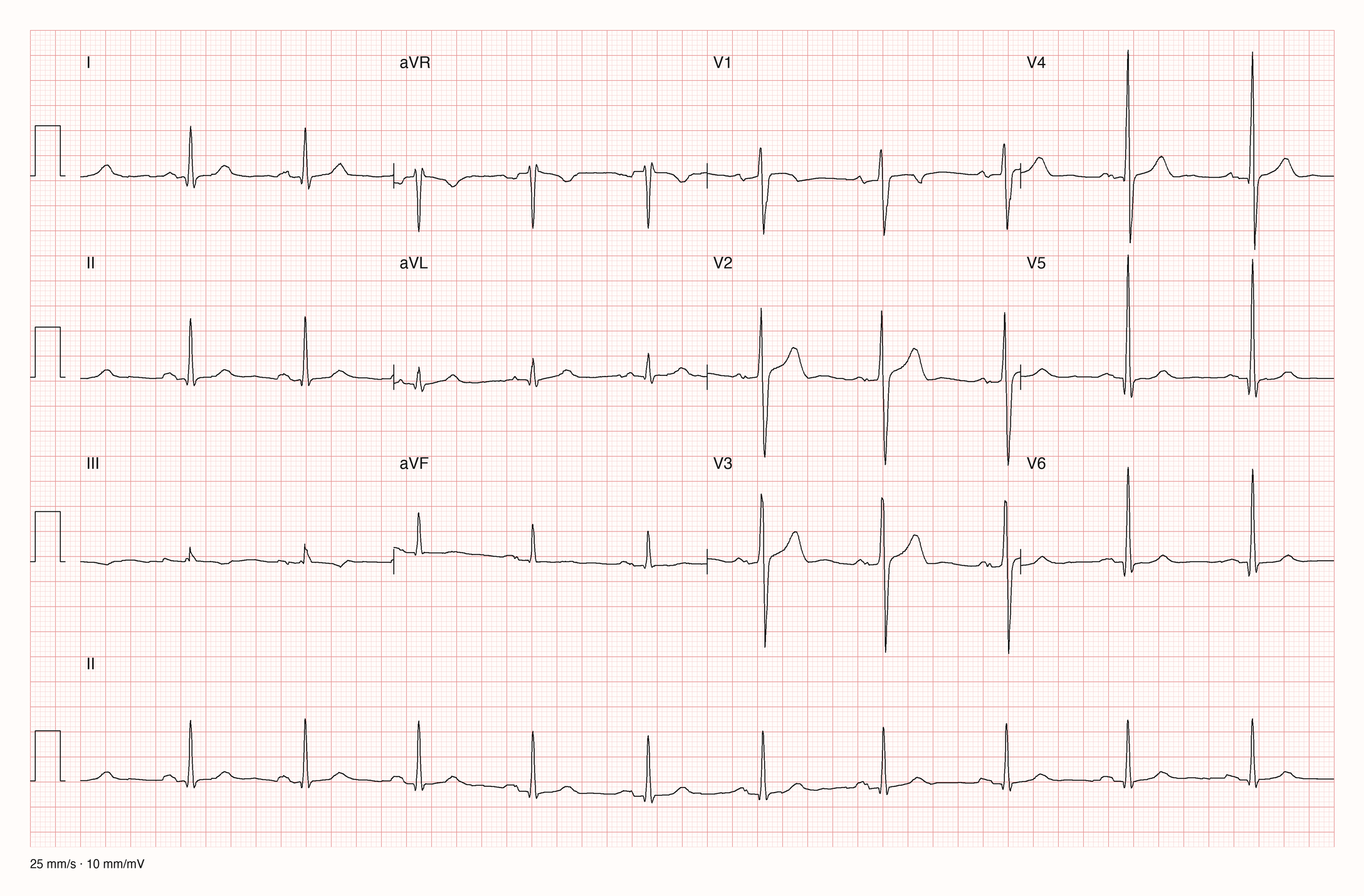 12-Kanal-EKG 3785; zur systematischen Befundung