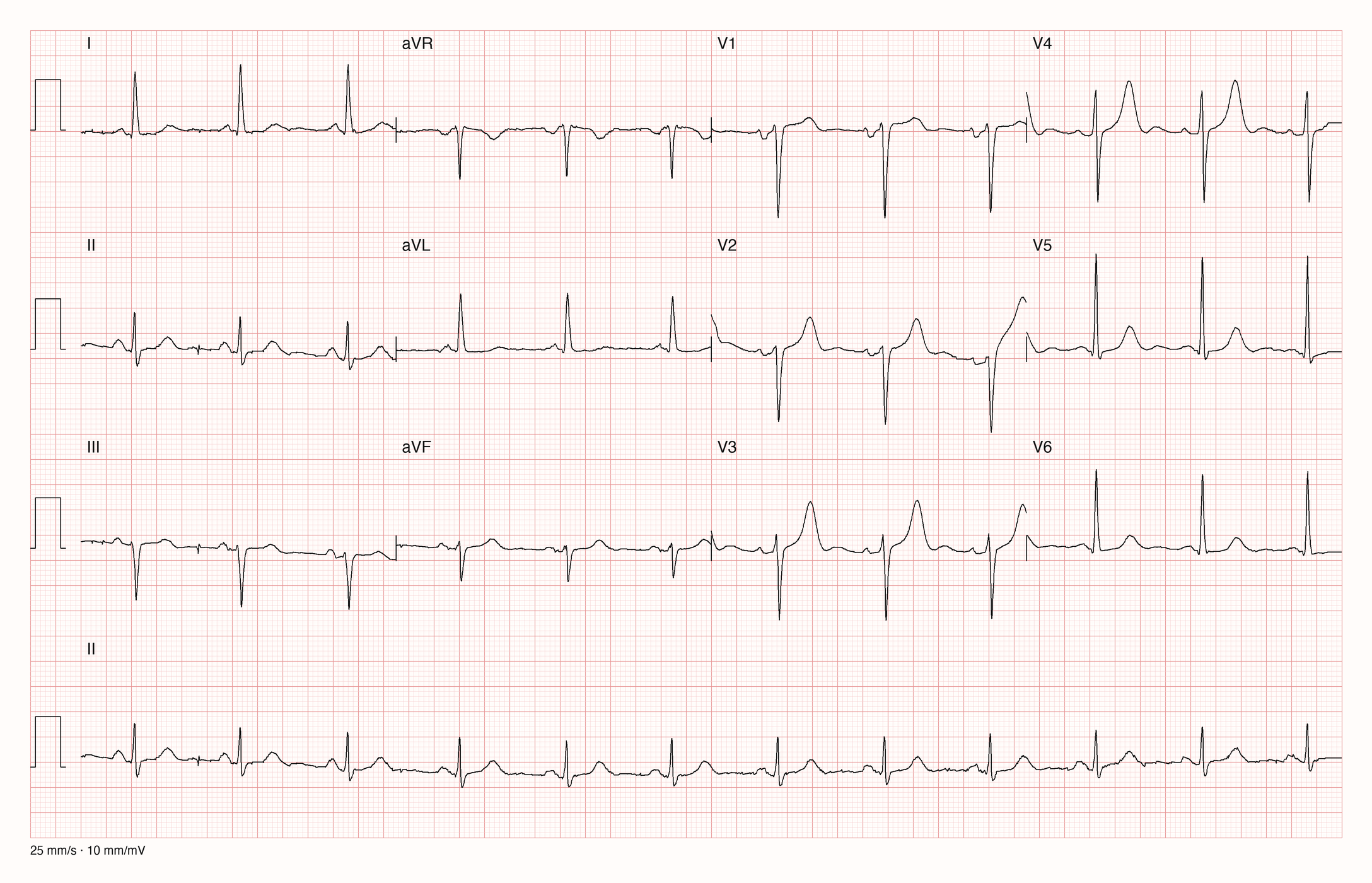 12-Kanal-EKG 3790; zur systematischen Befundung