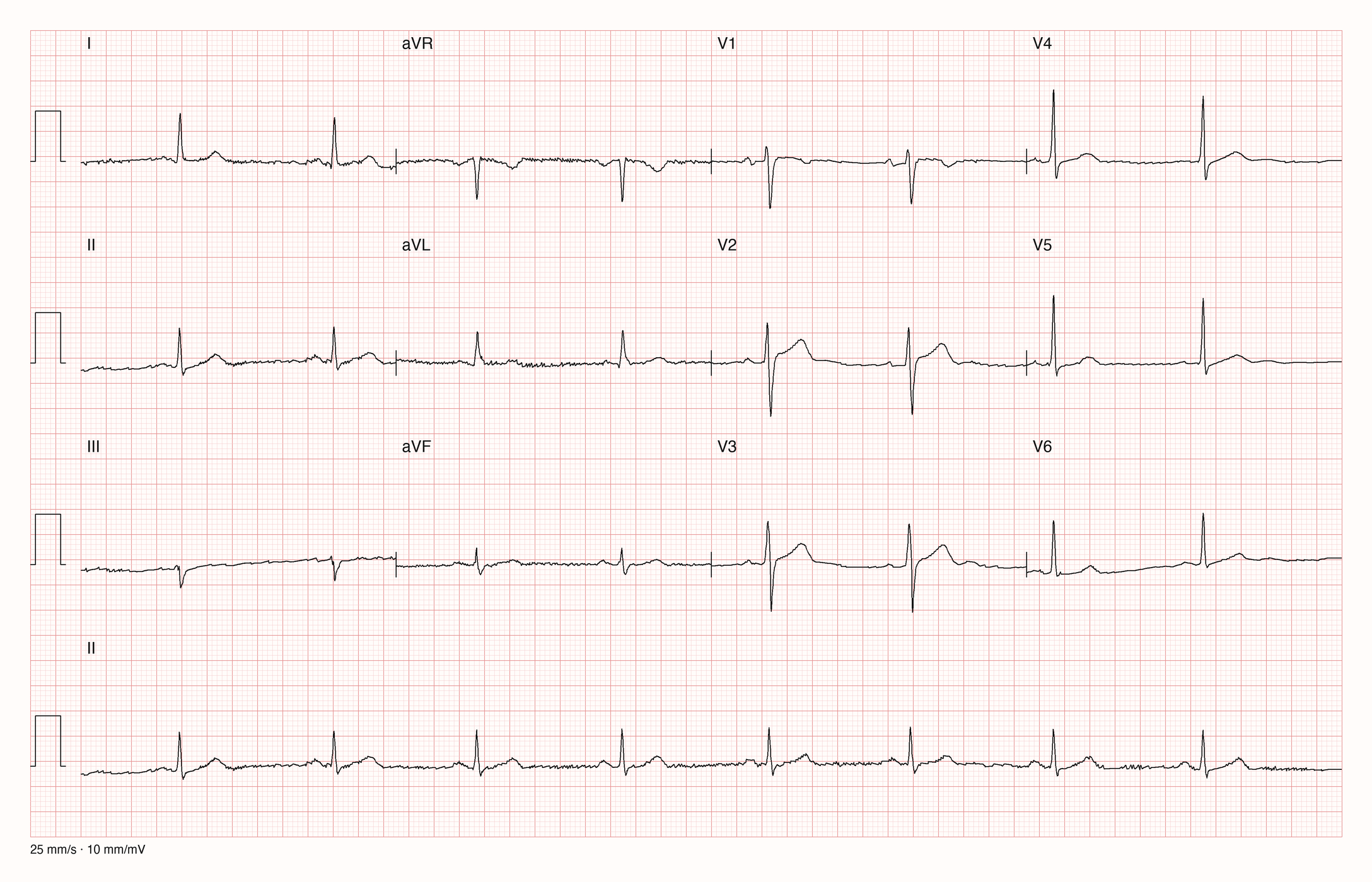 12-Kanal-EKG 4059; zur systematischen Befundung