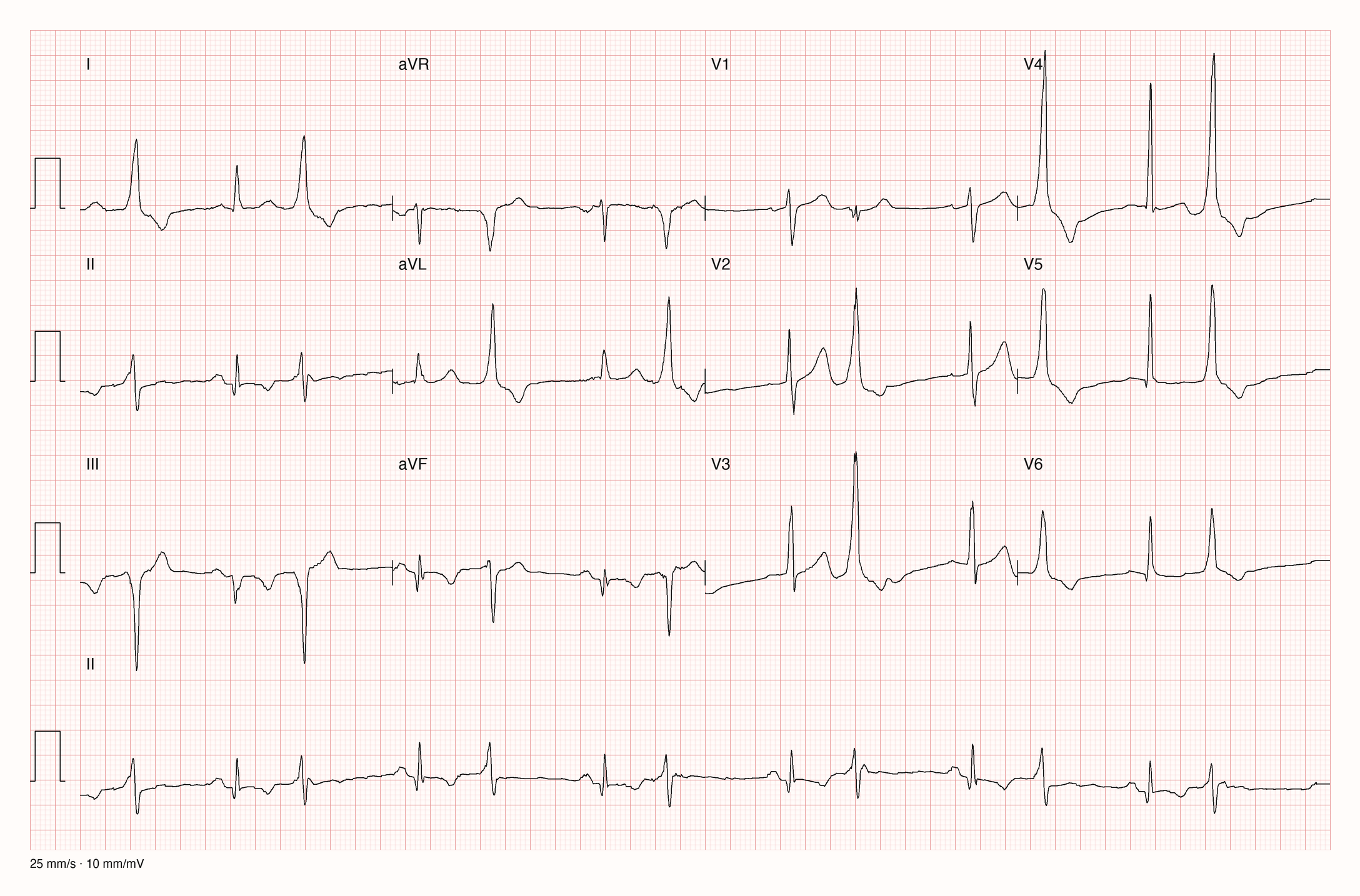 12-Kanal-EKG mit Rhythmusstreifen II, Datensatzkennung 4637