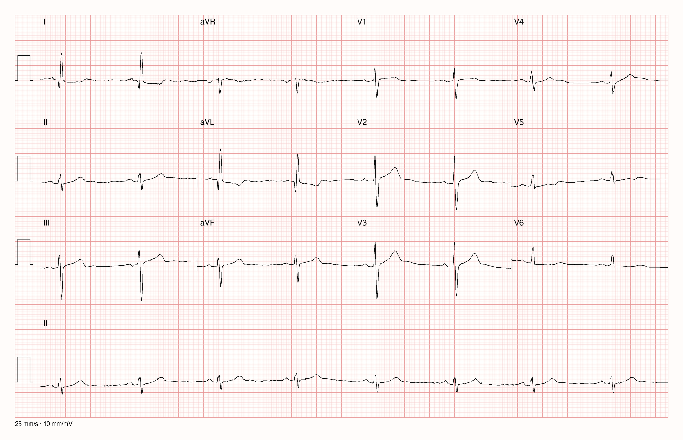 12-Kanal-EKG 4712; zur systematischen Befundung