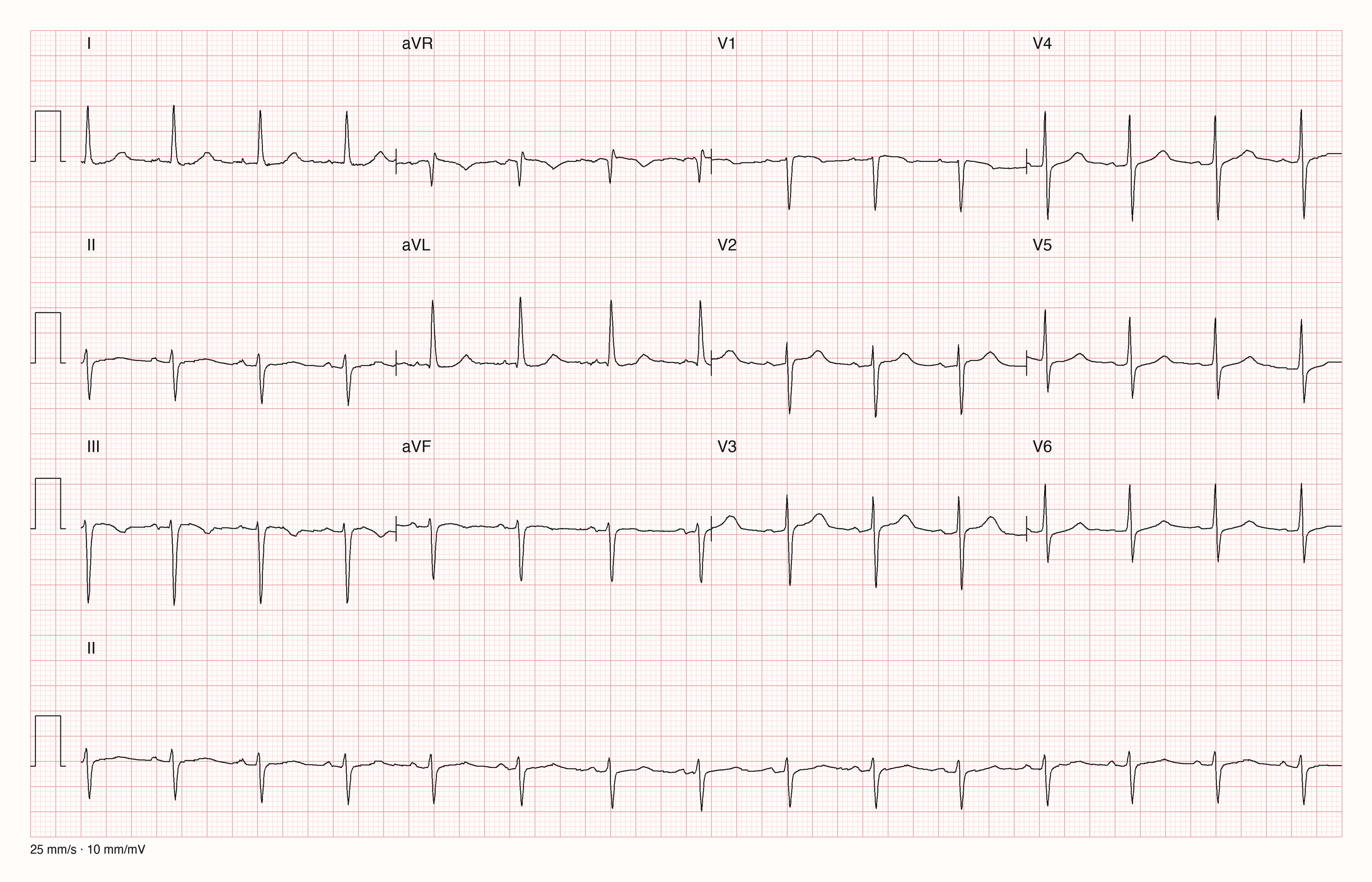 12-Kanal-EKG 520; zur systematischen Befundung