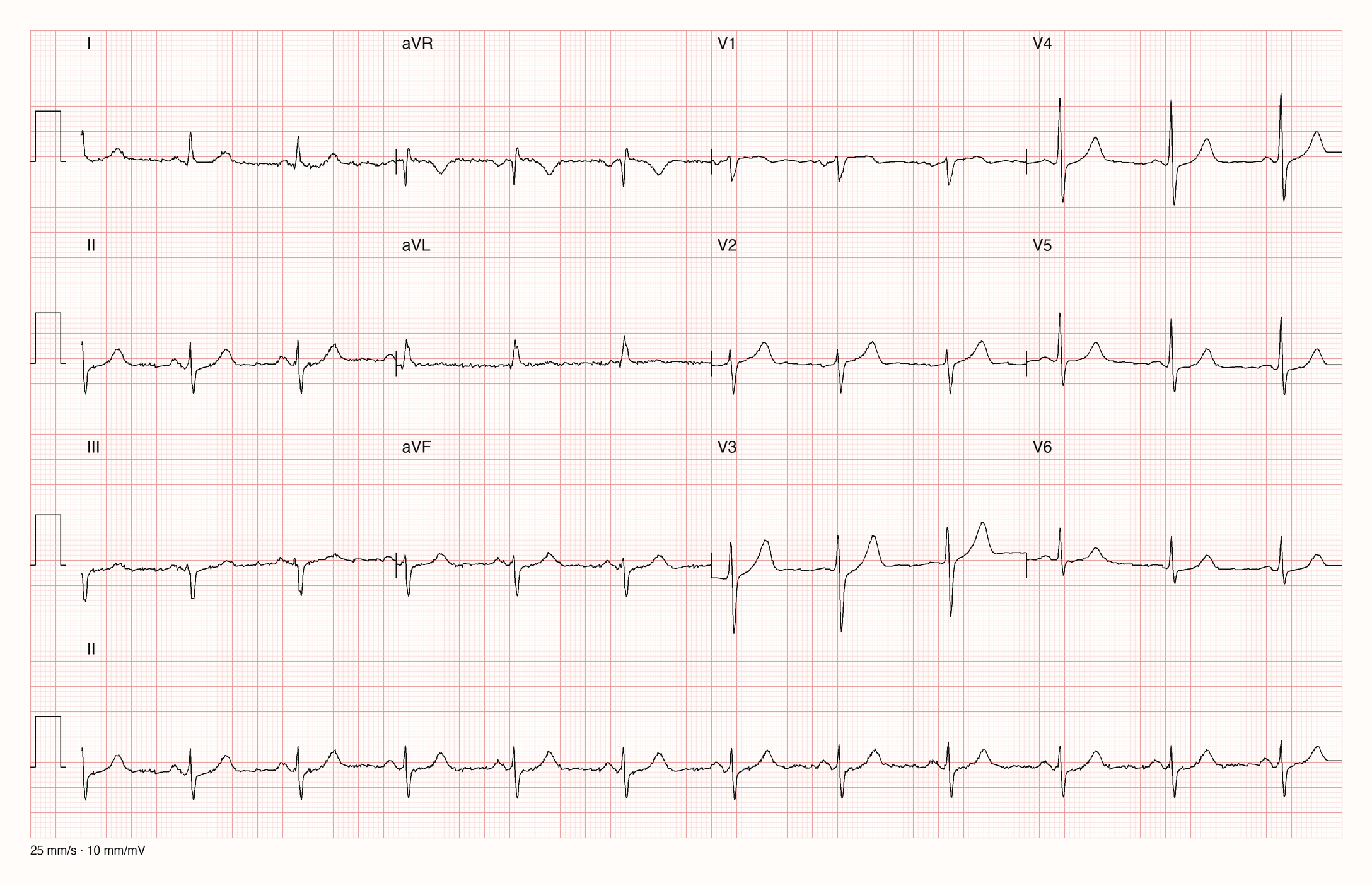 12-Kanal-EKG 633; zur systematischen Befundung