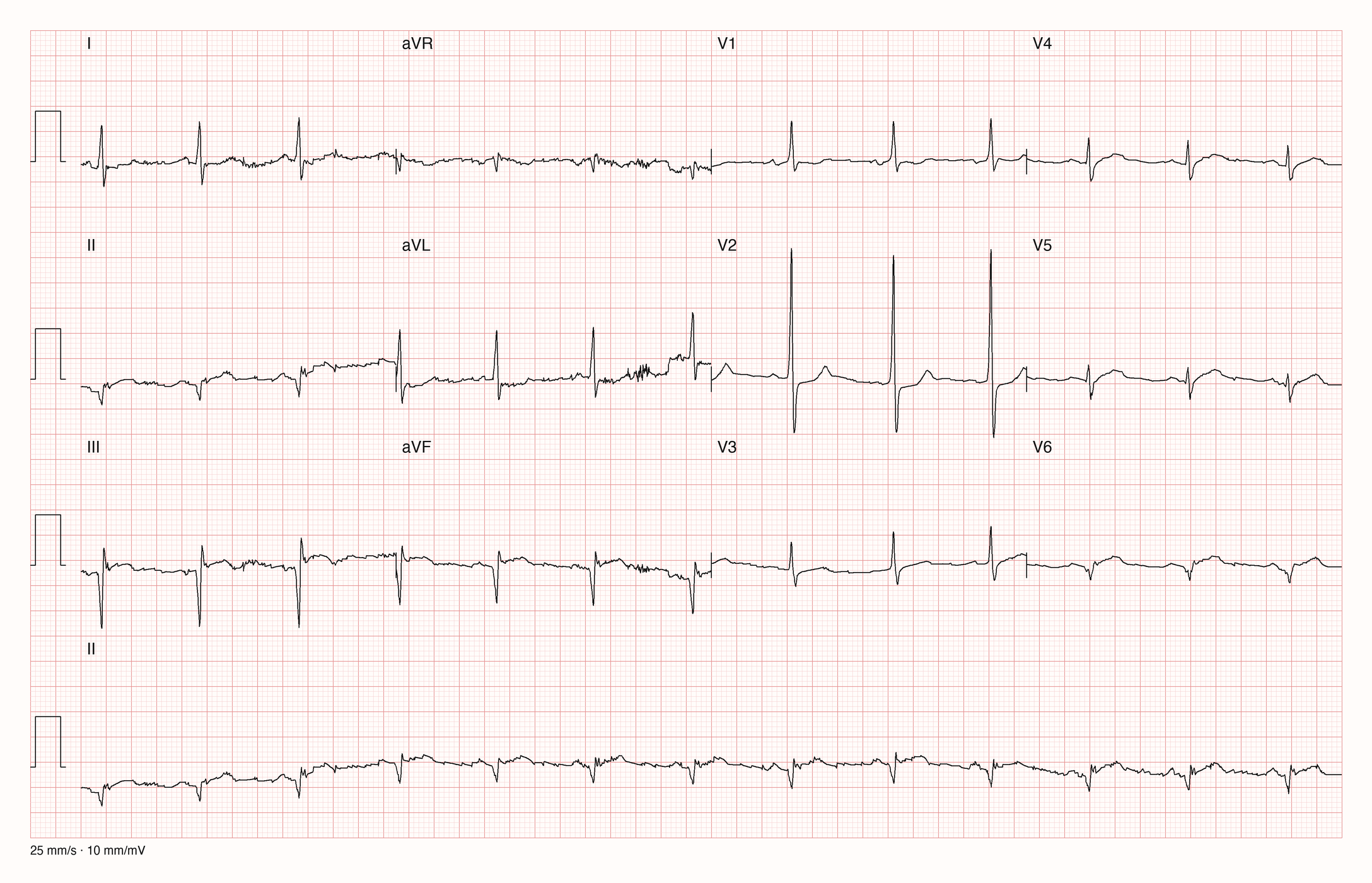 12-Kanal-EKG 6962; zur systematischen Befundung