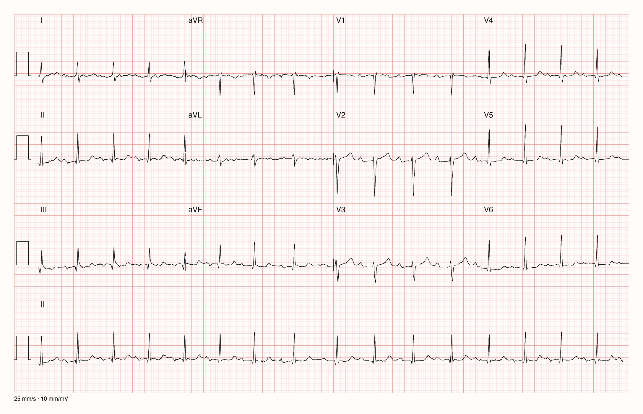 12-Kanal-EKG 7079; zur systematischen Befundung