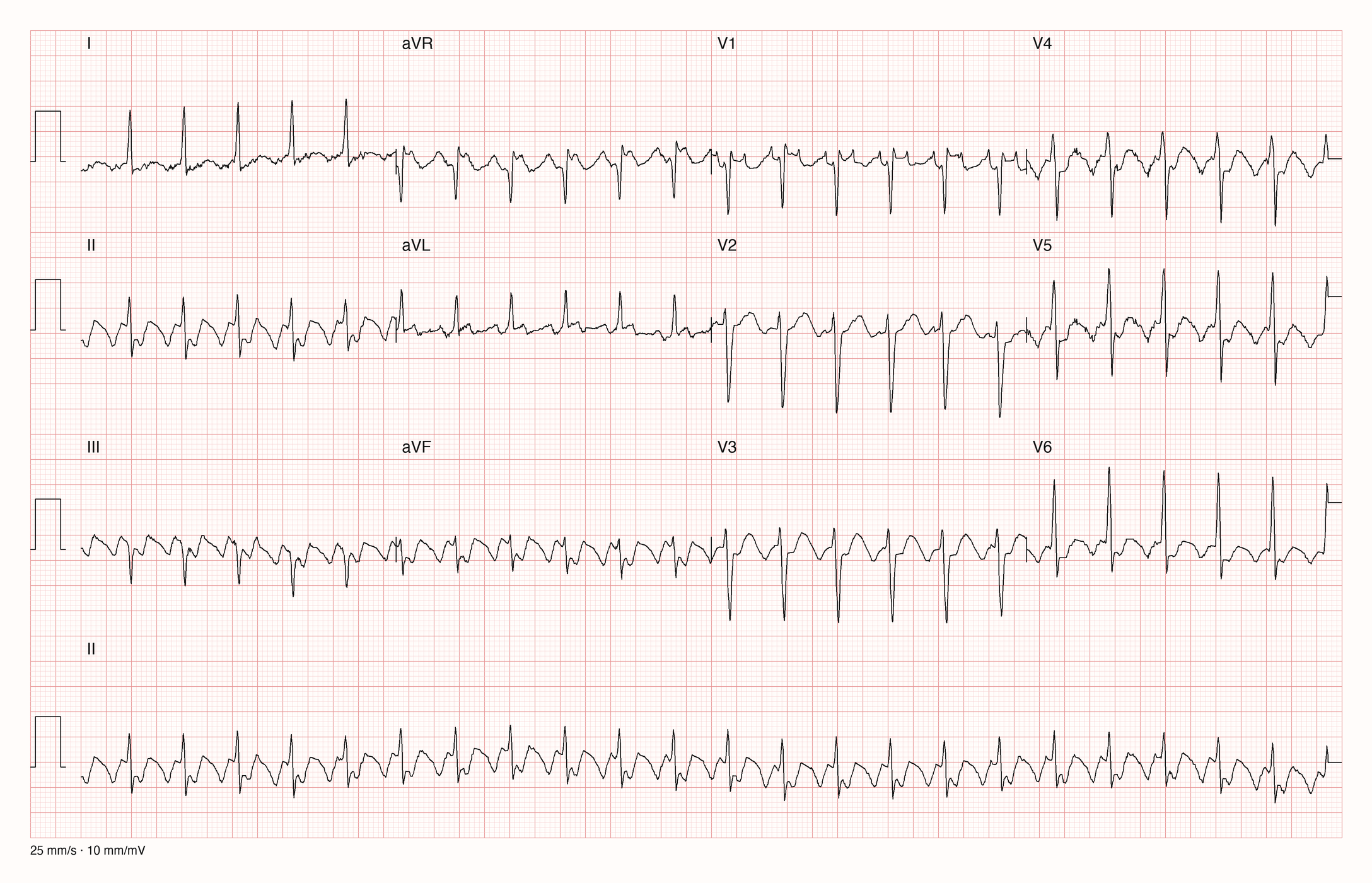 12-Kanal-EKG mit Rhythmusstreifen II, Datensatzkennung 7159