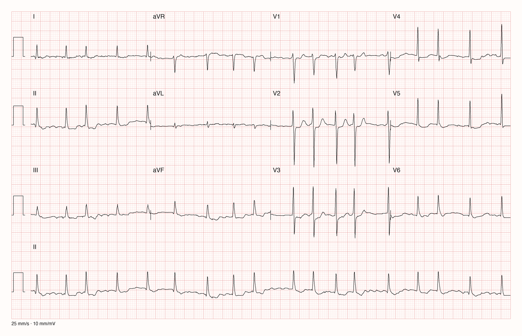 12-Kanal-EKG 7525; zur systematischen Befundung