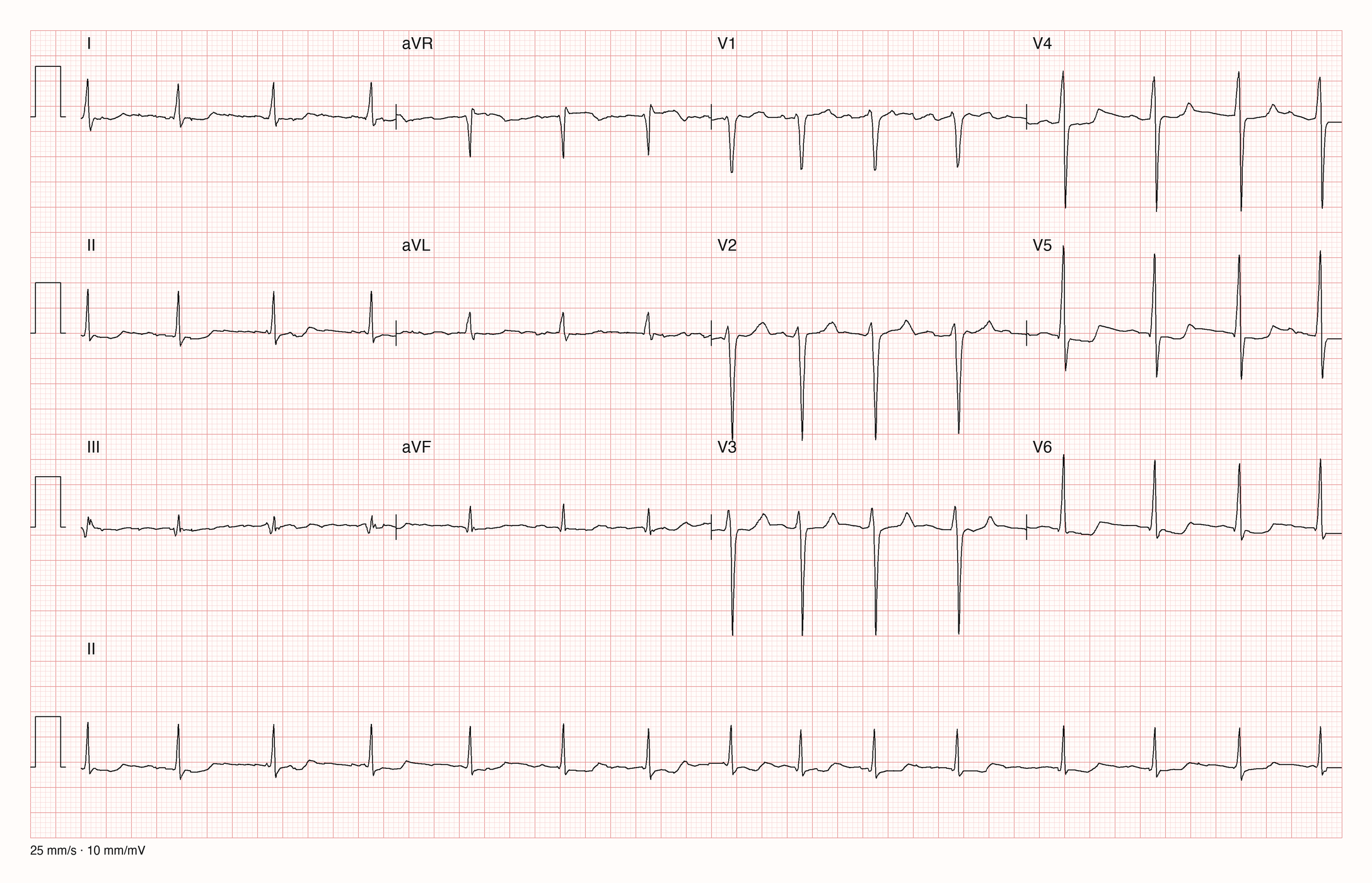 12-Kanal-EKG 7909; zur systematischen Befundung