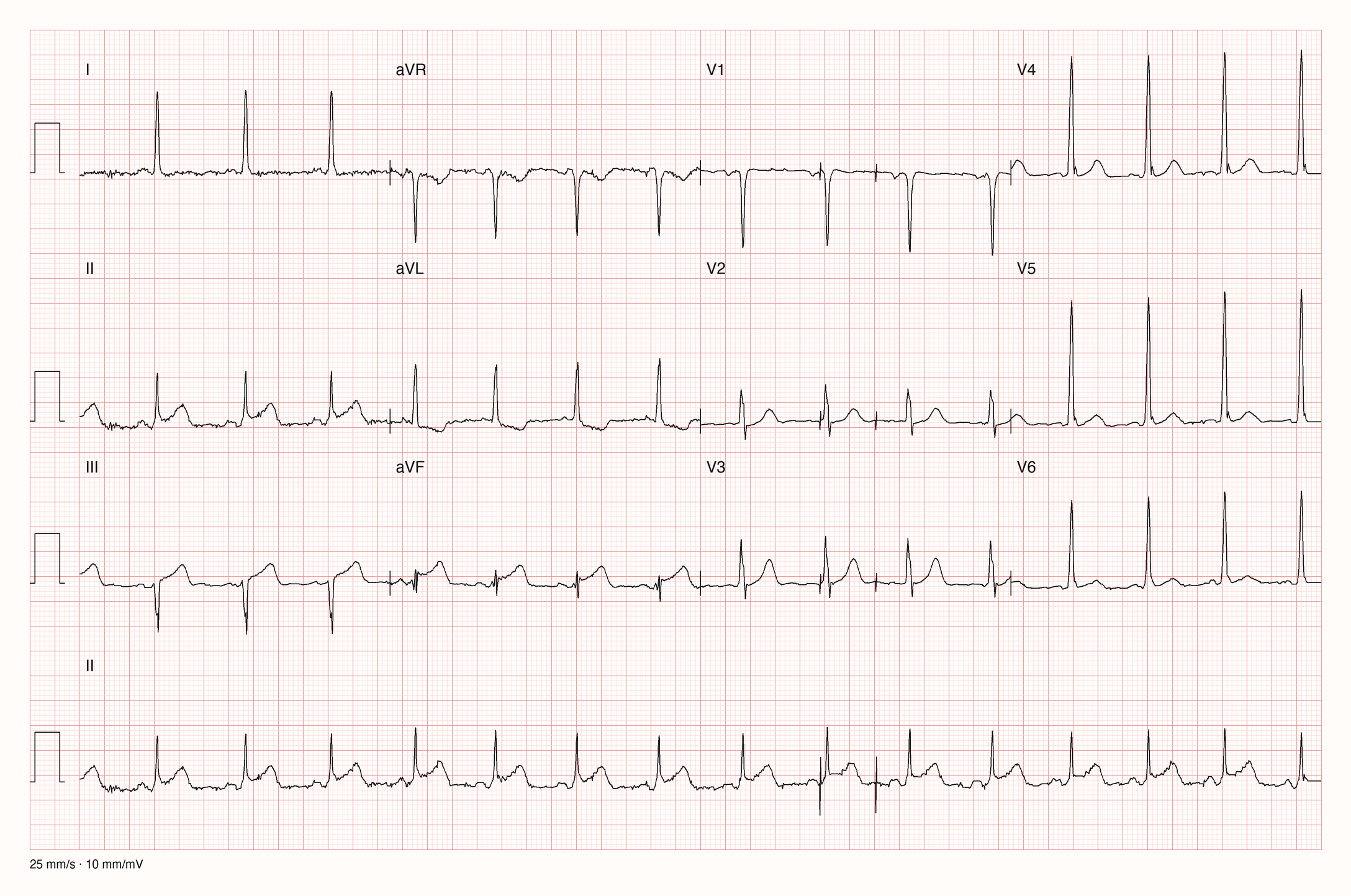 12-Kanal-EKG 8075; zur systematischen Befundung