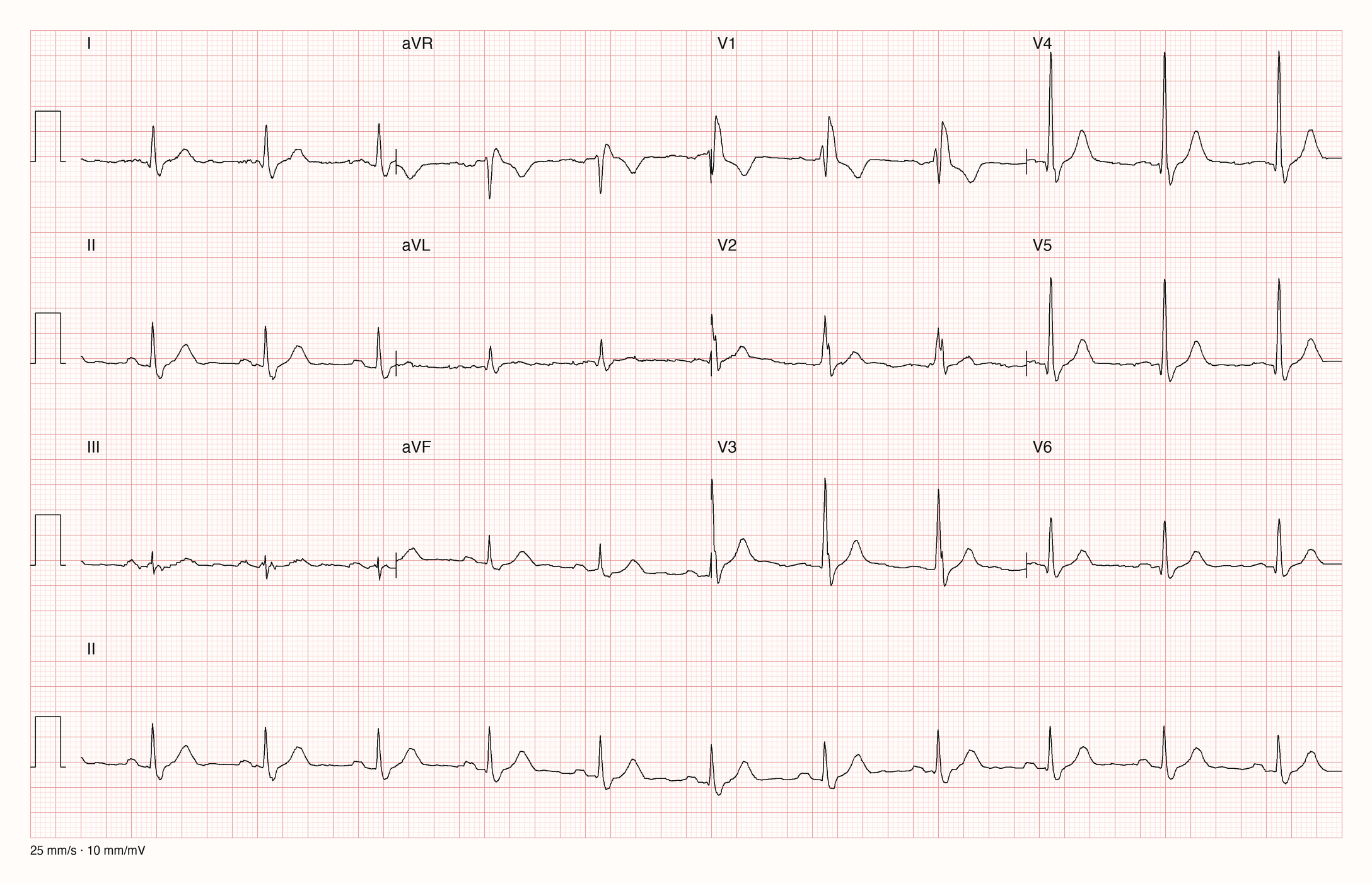 12-Kanal-EKG 8504; zur systematischen Befundung