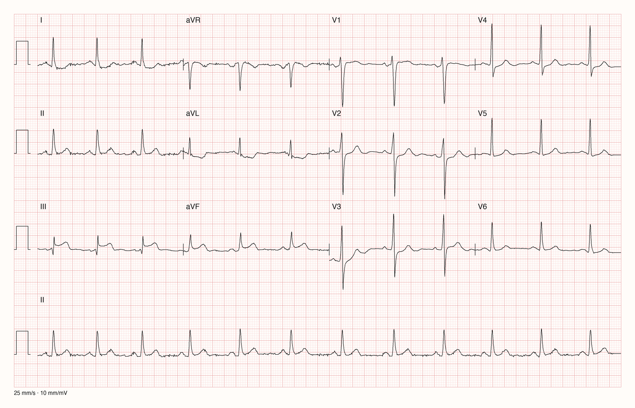 12-Kanal-EKG 8611; zur systematischen Befundung
