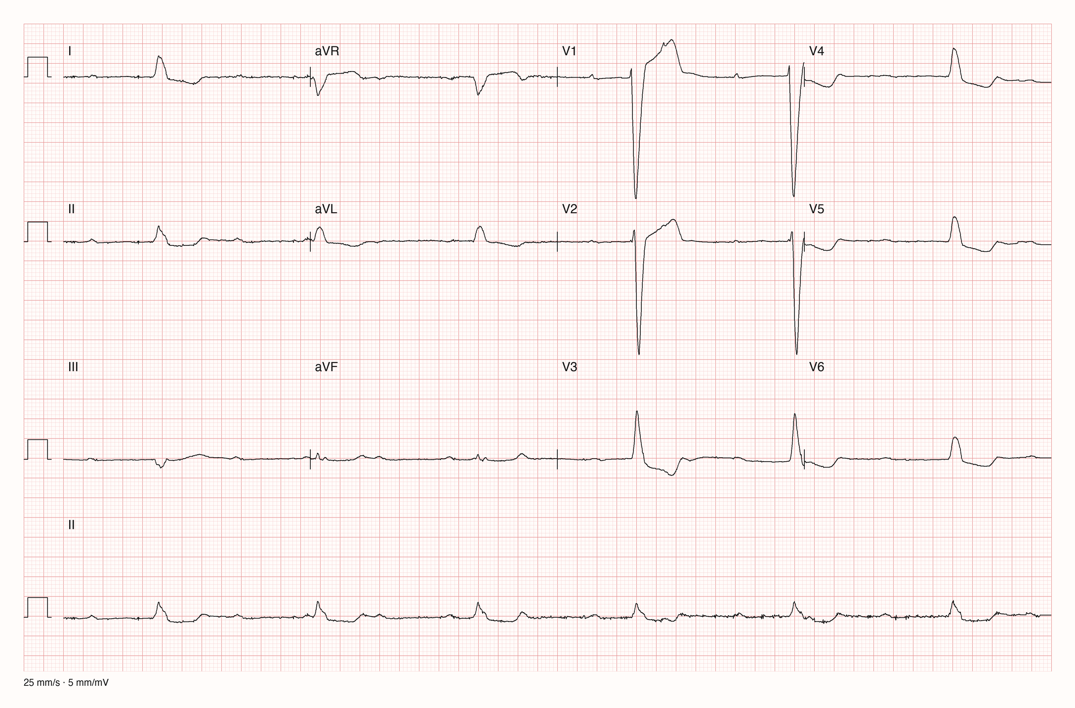 12-Kanal-EKG 8620; zur systematischen Befundung