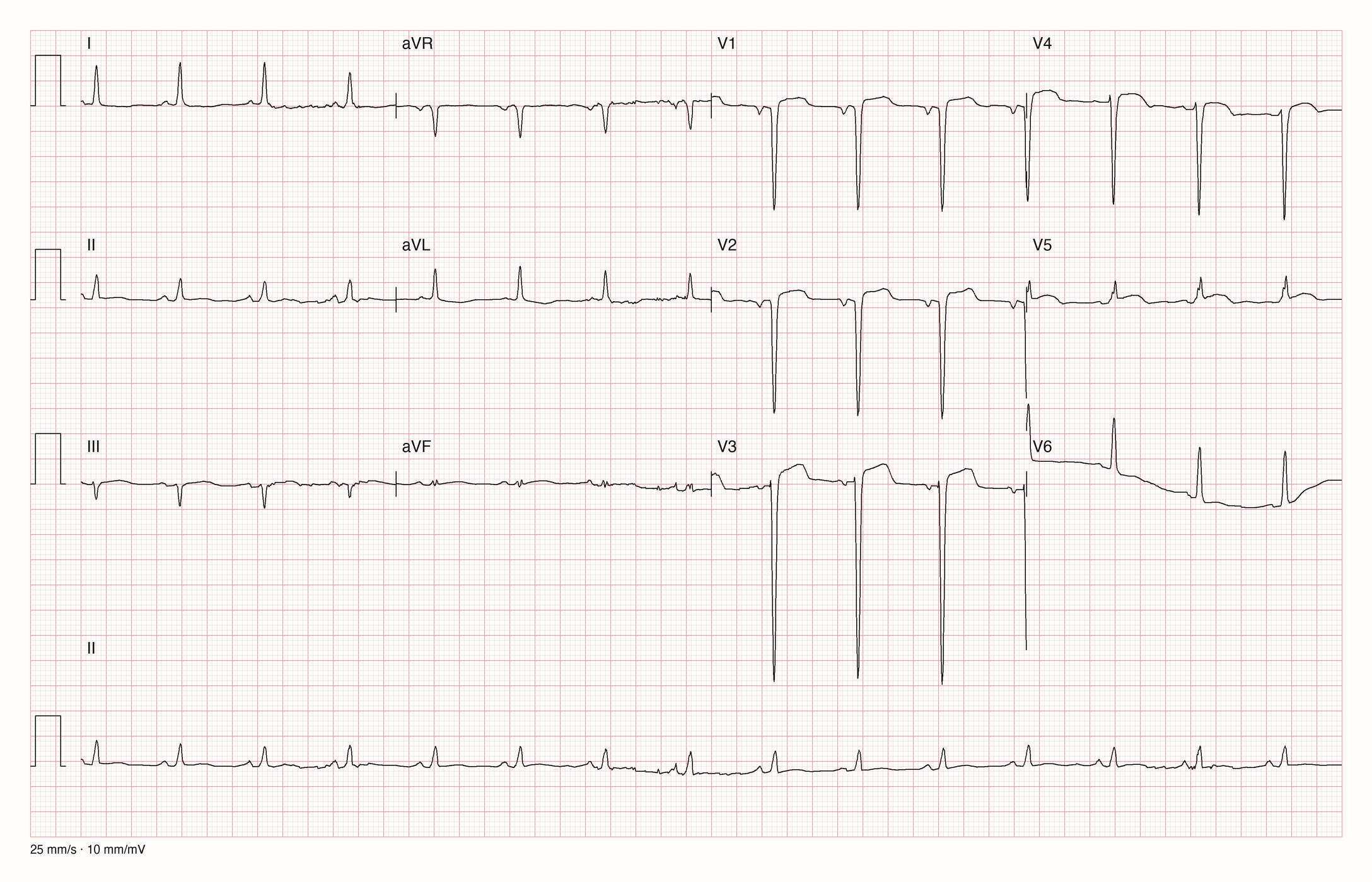12-Kanal-EKG 8636; zur systematischen Befundung