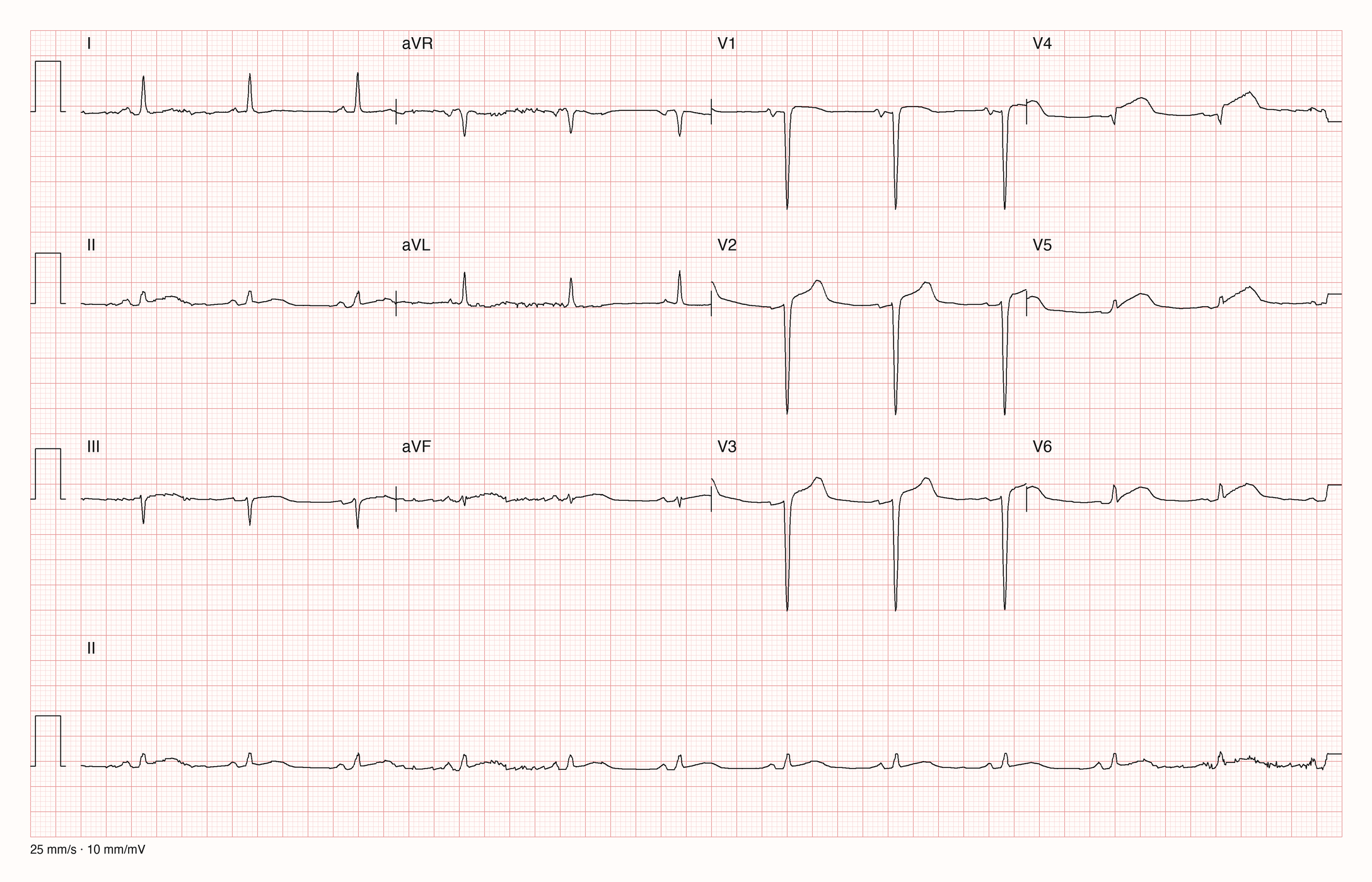 12-Kanal-EKG 8652; zur systematischen Befundung
