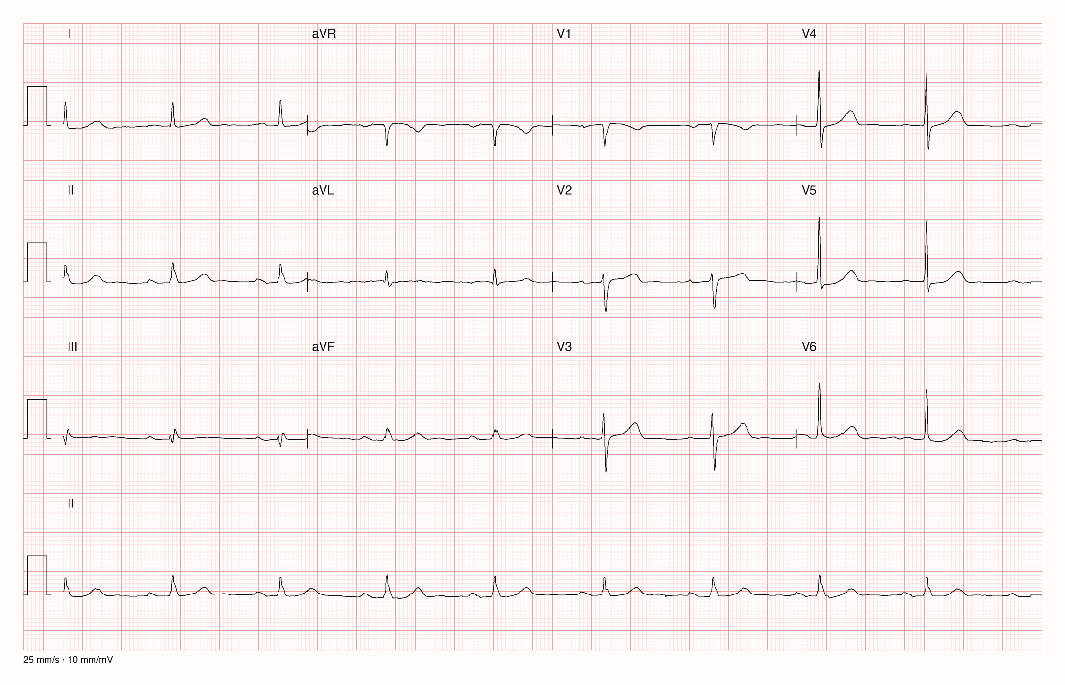 12-Kanal-EKG 9108; zur systematischen Befundung