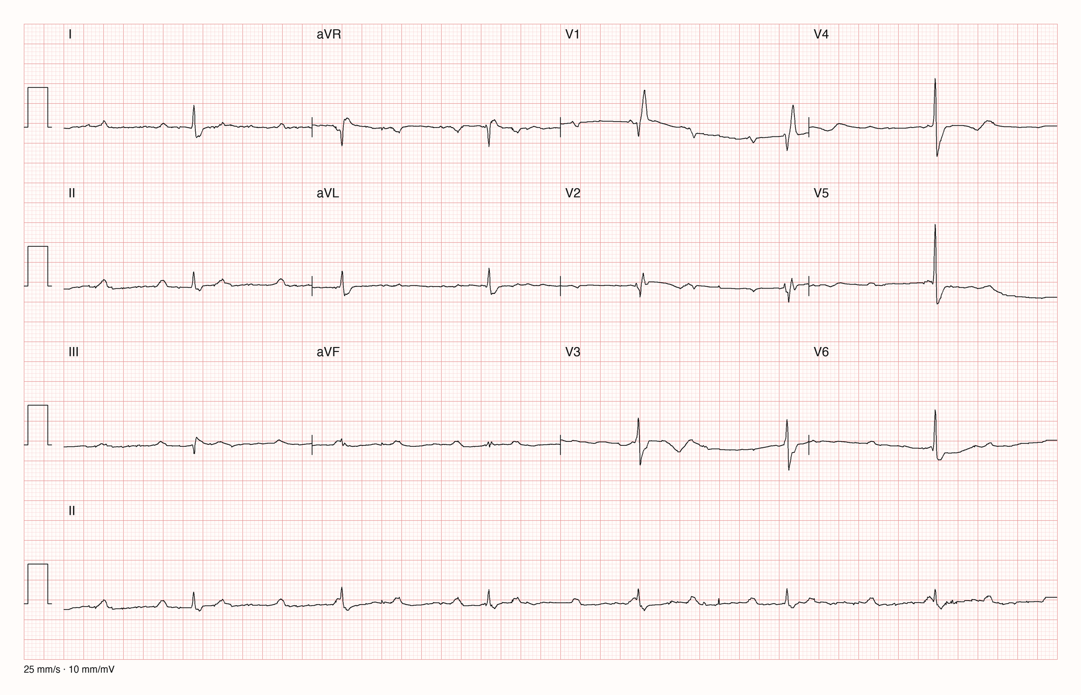 12-Kanal-EKG 959; zur systematischen Befundung