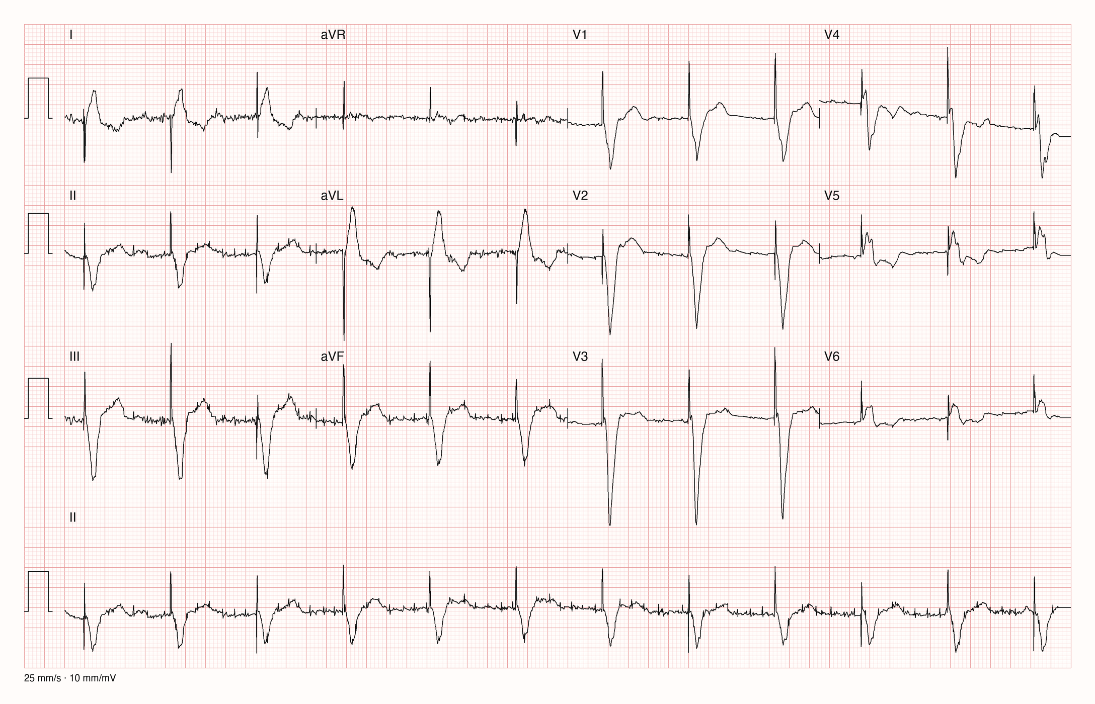 12-Kanal-EKG 1641 zur systematischen Befundung