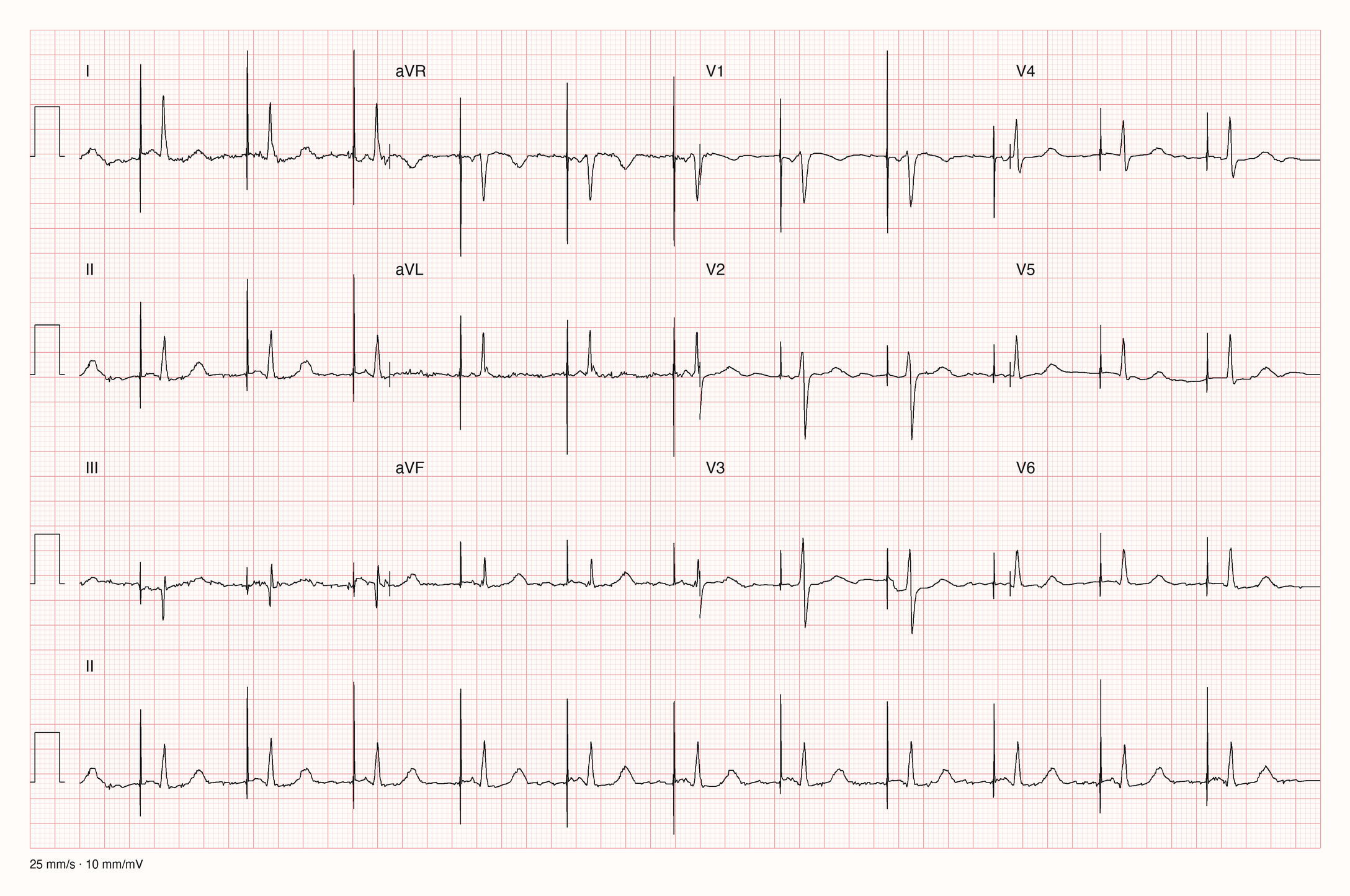 12-Kanal-EKG 20886 zur systematischen Befundung