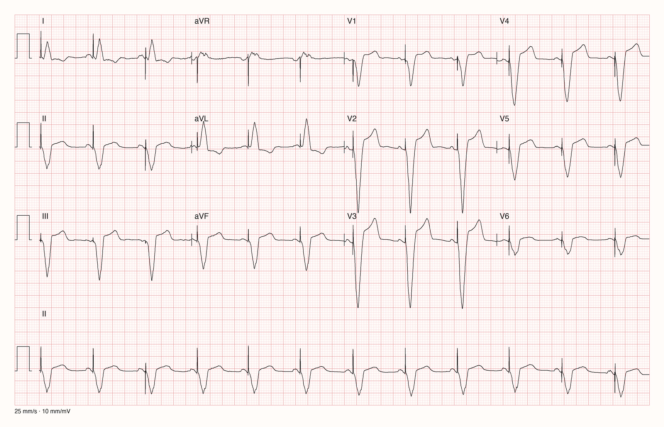 12-Kanal-EKG 3723 zur systematischen Befundung