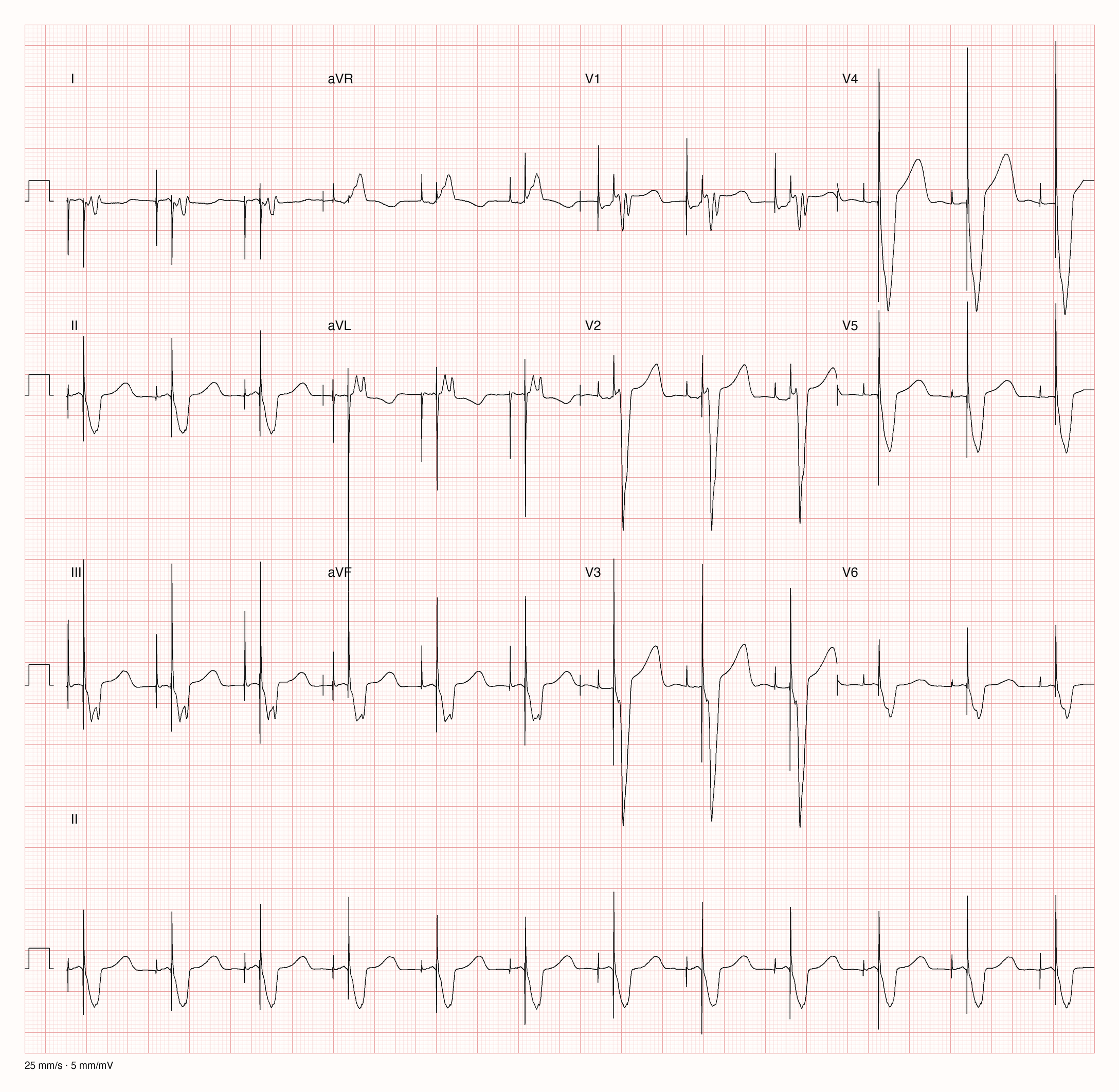 12-Kanal-EKG 9129 zur systematischen Befundung