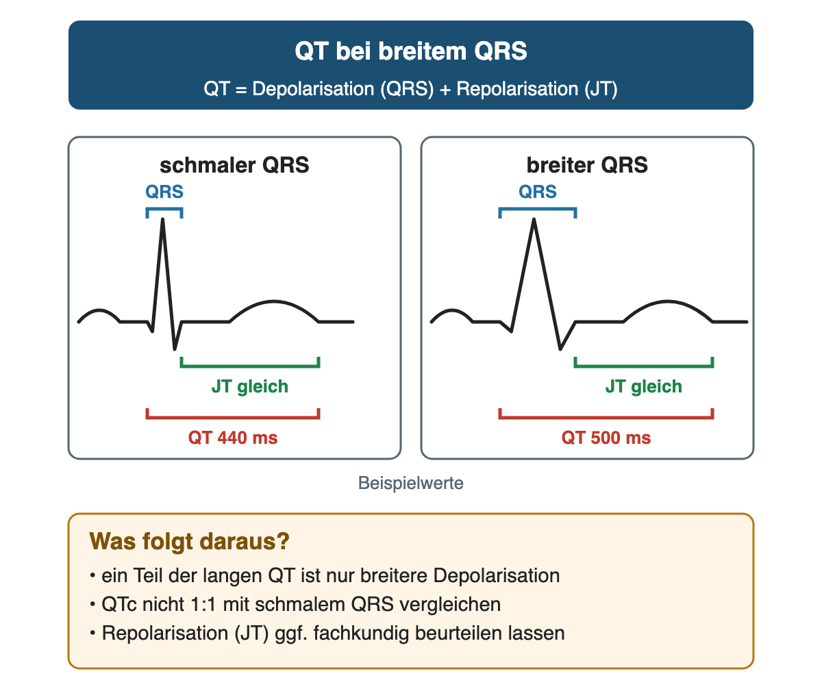 Zwei schematische Herzschläge nebeneinander: links schmaler QRS mit QT 440 ms, rechts breiter QRS mit QT 500 ms bei gleicher JT-Strecke; die längere QT entsteht hier nur durch die breitere Depolarisation. Folgerung: QTc nicht eins zu eins mit schmalem QRS vergleichen, Repolarisation gegebenenfalls fachkundig beurteilen lassen