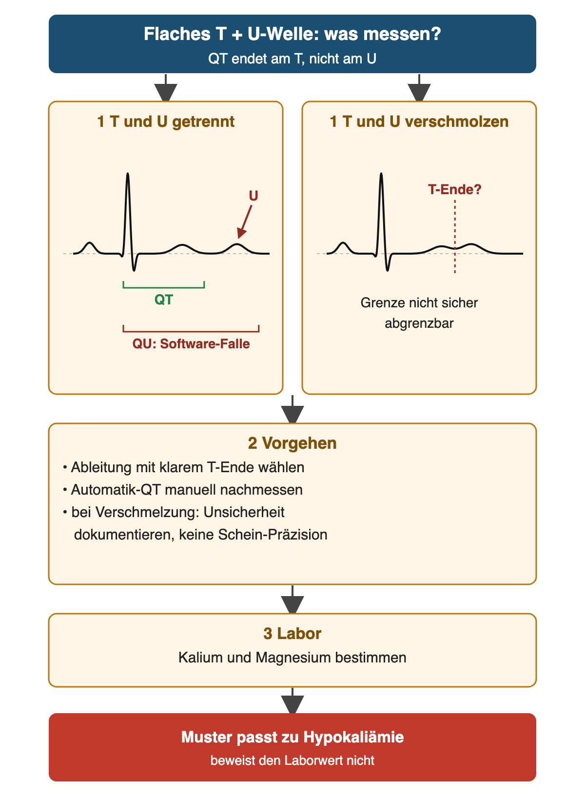 Flaches T mit U-Welle, was wird gemessen: links T und U getrennt, die QT endet am Ende der T-Welle, die längere Strecke bis zum Ende der U-Welle ist die QU und eine typische Software-Falle; rechts T und U verschmolzen, das T-Ende ist nicht sicher abgrenzbar. Vorgehen: Ableitung mit klarem T-Ende wählen, automatische QT manuell nachmessen, bei Verschmelzung die Unsicherheit dokumentieren statt einer scheinpräzisen Zahl. Labor: Kalium und Magnesium bestimmen. Ergebnis: Das Muster passt zu Hypokaliämie, beweist den Laborwert aber nicht