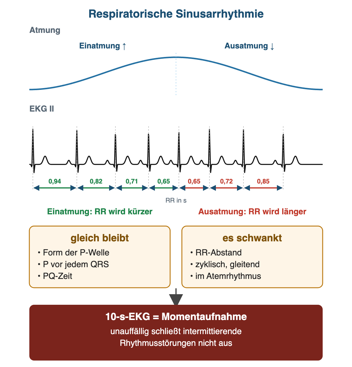 Schema der respiratorischen Sinusarrhythmie: Atemkurve über einer EKG-Folge; die RR-Abstände werden während der Einatmung schrittweise kürzer (0,94 bis 0,65 s) und während der Ausatmung wieder länger (0,65 bis 0,85 s); P-Form, P vor jedem QRS und PQ-Zeit bleiben gleich; ein 10-Sekunden-EKG ist nur eine Momentaufnahme