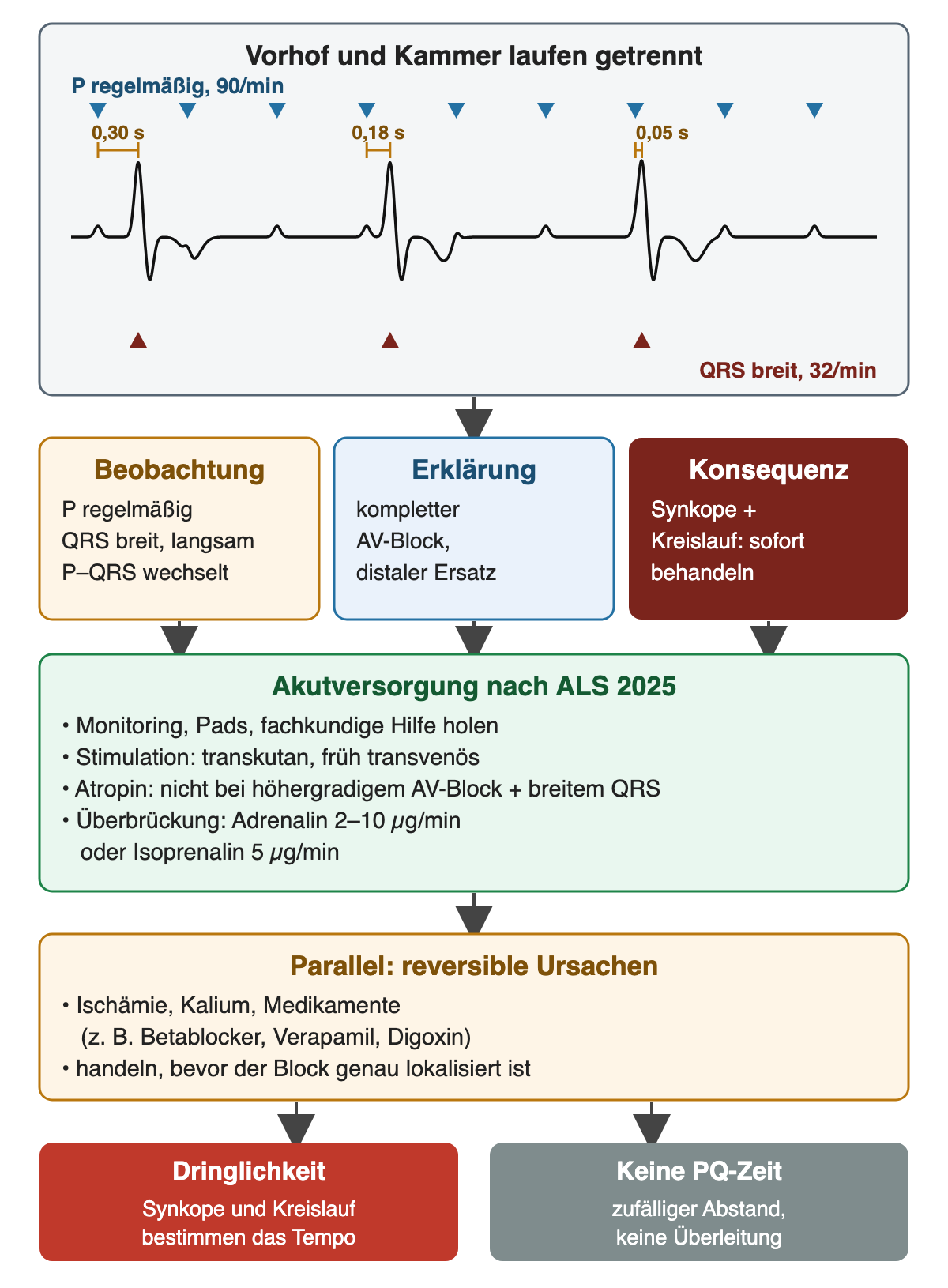 Oben schematischer Streifen: P-Wellen regelmäßig mit 90/min, markiert durch blaue Dreiecke, breite QRS-Komplexe mit 32/min, markiert durch rote Dreiecke; die Abstände von P zum folgenden QRS betragen 0,30 s, 0,18 s und 0,05 s, also ohne feste Kopplung. Darunter drei Spalten: Beobachtung mit regelmäßigen P, breiten langsamen QRS und wechselndem P-QRS-Abstand; Erklärung kompletter AV-Block mit distalem Ersatz; Konsequenz Synkope und Kreislaufbeeinträchtigung, sofort behandeln. Akutversorgung nach ALS 2025: Monitoring, Pads, fachkundige Hilfe; Stimulation transkutan und früh transvenös; kein Atropin bei höhergradigem AV-Block mit breitem QRS; Überbrückung mit Adrenalin 2 bis 10 Mikrogramm pro Minute oder Isoprenalin 5 Mikrogramm pro Minute. Parallel reversible Ursachen wie Ischämie, Kalium und Medikamente, zum Beispiel Betablocker, Verapamil, Digoxin; handeln, bevor der Block genau lokalisiert ist. Ergebnis: Synkope und Kreislauf bestimmen das Tempo; keine PQ-Zeit, weil der Abstand zufällig ist