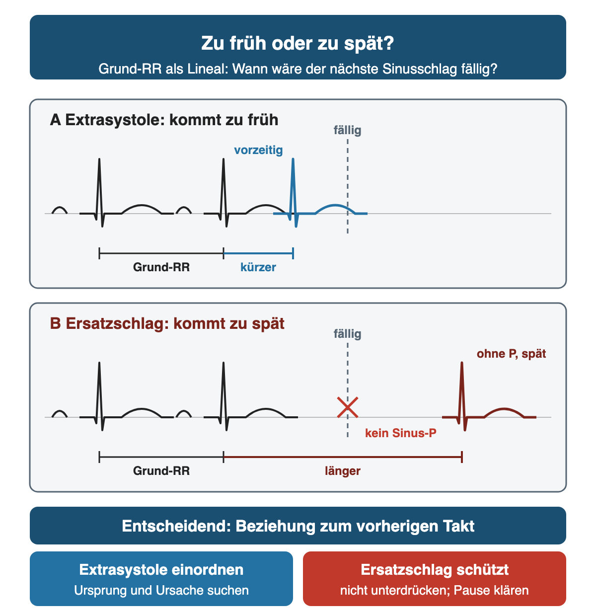 Zwei schematische Rhythmusstreifen mit gleichem Grund-RR und einer gestrichelten Linie beim fälligen nächsten Schlag: oben ein vorzeitiger QRS vor der Linie mit kürzerem RR, unten ein ausgefallener Sinusschlag und ein später QRS ohne P-Welle nach der Linie mit längerem RR