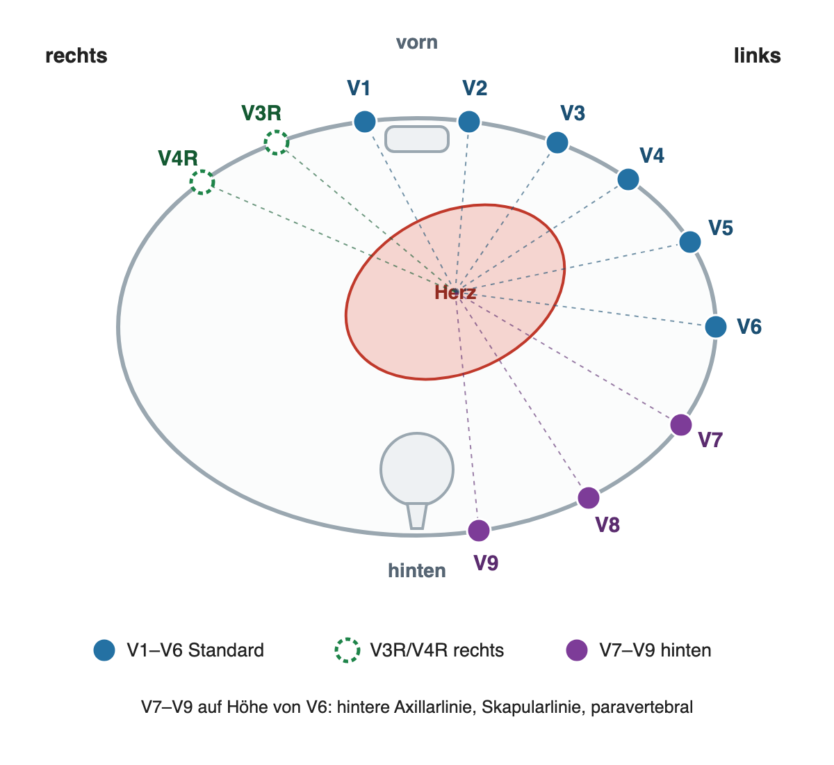 Horizontaler Querschnitt durch den Brustkorb mit dem Herzen links vorn: V1 bis V6 an der vorderen und linken seitlichen Brustwand, V3R und V4R spiegelbildlich rechts vorn, V7 bis V9 links hinten bis neben die Wirbelsäule