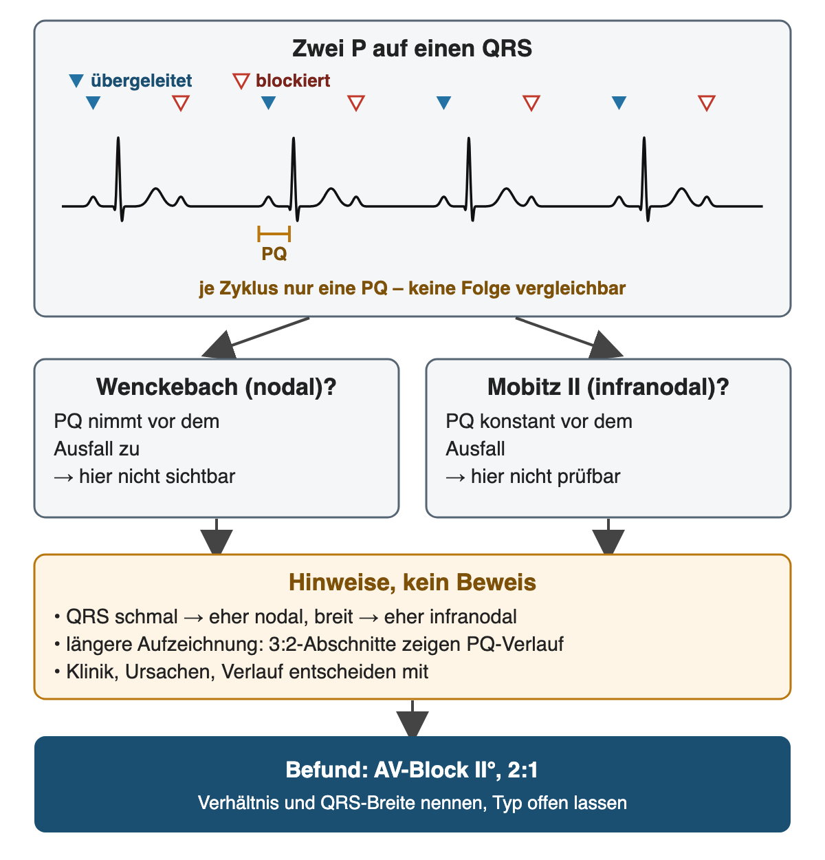 Schematischer Streifen mit regelmäßigen P-Wellen, von denen abwechselnd eine übergeleitet wird, blau markiert, und eine blockiert ist, rot umrandet; je Zyklus gibt es nur eine messbare PQ-Zeit, also keine Folge zum Vergleichen. Darunter zwei Möglichkeiten: Wenckebach, nodal, mit zunehmender PQ vor dem Ausfall, hier nicht sichtbar; Mobitz II, infranodal, mit konstanter PQ vor dem Ausfall, hier nicht prüfbar. Hinweise, kein Beweis: schmaler QRS eher nodal, breiter QRS eher infranodal; längere Aufzeichnung mit 3:2-Abschnitten zeigt den PQ-Verlauf; Klinik, Ursachen und Verlauf entscheiden mit. Ergebnis: Befund AV-Block II. Grades 2:1, Verhältnis und QRS-Breite nennen, Typ offen lassen