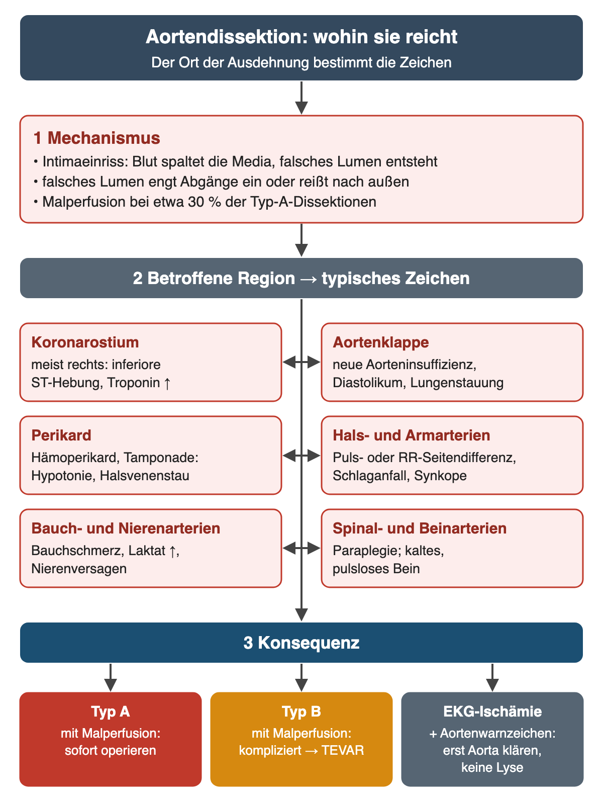 Diagramm: Mechanismus der Aortendissektion mit Intimaeinriss und falschem Lumen; sechs Regionen mit typischem Zeichen: Koronarostium meist rechts mit inferiorer ST-Hebung und Troponinanstieg, Aortenklappe mit neuer Aorteninsuffizienz, Perikard mit Hämoperikard und Tamponade, Hals- und Armarterien mit Puls- oder Blutdruckseitendifferenz, Schlaganfall oder Synkope, Bauch- und Nierenarterien mit Bauchschmerz, Laktatanstieg und Nierenversagen, Spinal- und Beinarterien mit Paraplegie und pulslosem Bein; unten Konsequenzen: Typ A mit Malperfusion sofort operieren, Typ B mit Malperfusion TEVAR, EKG-Ischämie mit Aortenwarnzeichen erst Aorta klären und keine Lyse