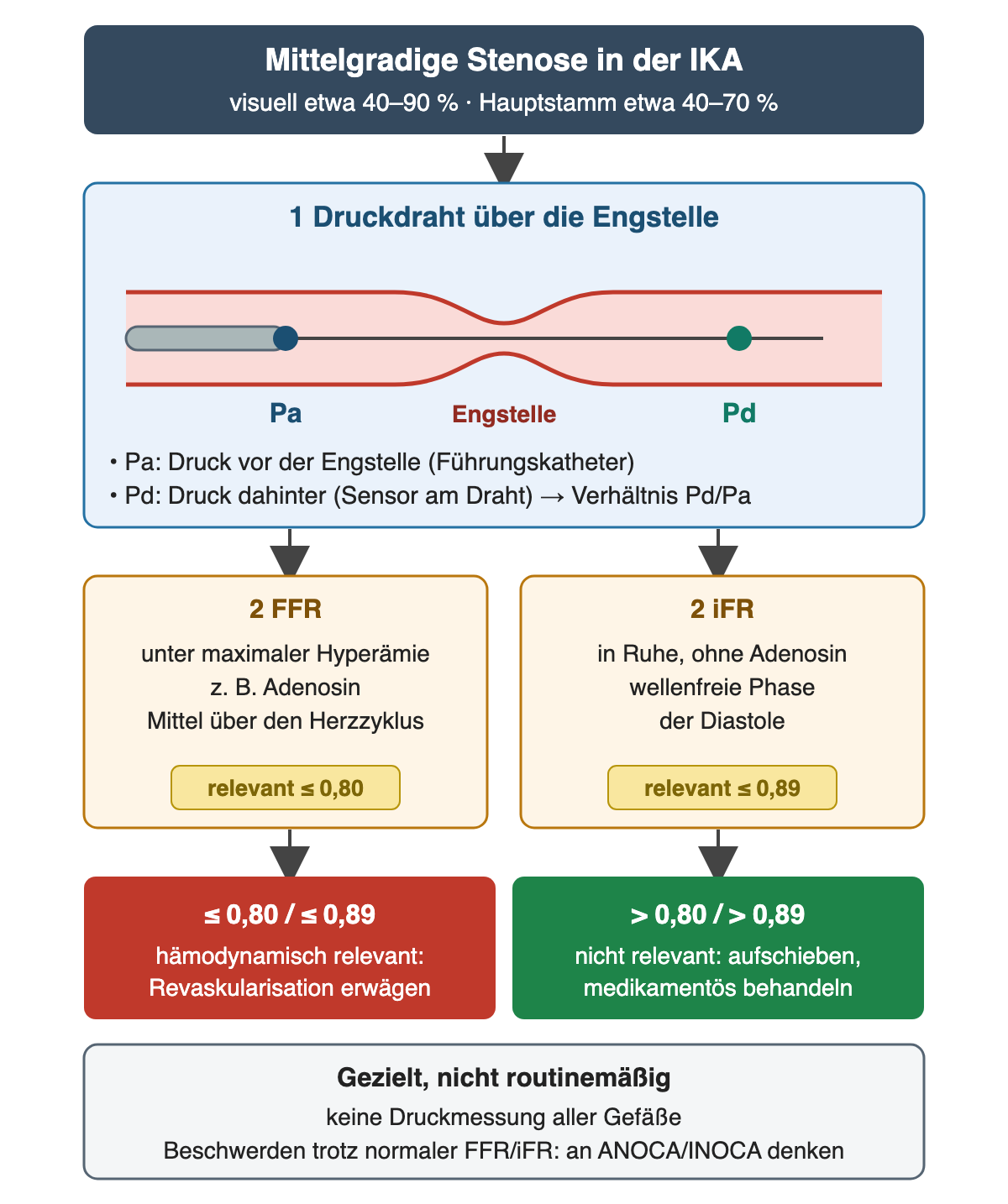 Kopf „Mittelgradige Stenose in der IKA“, visuell etwa 40–90 %, Hauptstamm etwa 40–70 %; 1 vereinfachtes Gefäß mit Führungskatheter, Druckdraht, Engstelle, Pa davor und Pd dahinter; 2 nebeneinander FFR unter maximaler Hyperämie mit Etikett „relevant ≤ 0,80“ und iFR in Ruhe in der wellenfreien Diastole mit Etikett „relevant ≤ 0,89“; unten rot „≤ 0,80 / ≤ 0,89 – Revaskularisation erwägen“ und grün „> 0,80 / > 0,89 – aufschieben, medikamentös“; graue Notiz: keine routinemäßige Messung aller Gefäße, bei Beschwerden trotz normaler Werte an ANOCA/INOCA denken.