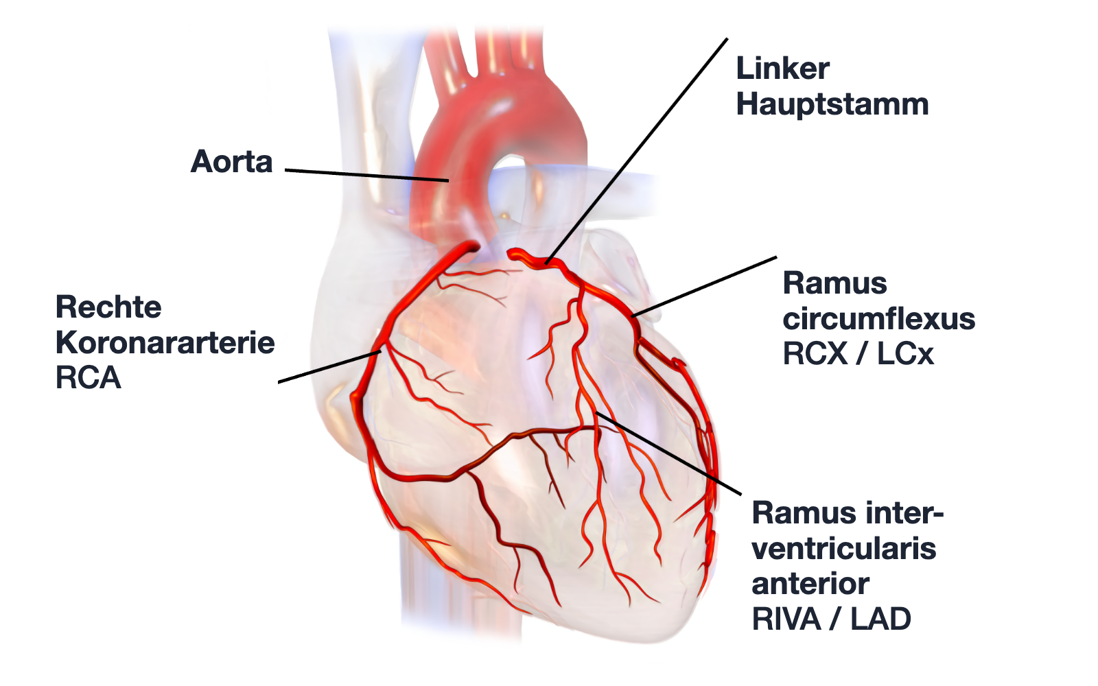 Herz von vorn mit Aorta, rechter Koronararterie, linkem Hauptstamm, Ramus circumflexus und Ramus interventricularis anterior