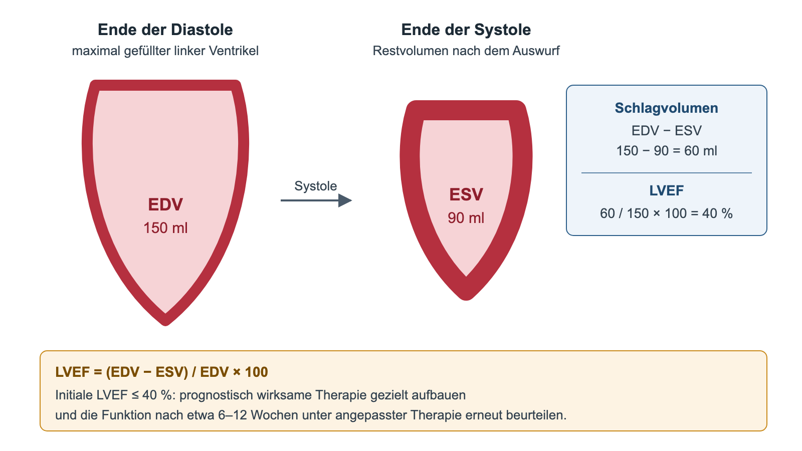 Schema des linken Ventrikels am Ende der Diastole mit 150 ml und am Ende der Systole mit 90 ml, daraus Schlagvolumen 60 ml und LVEF 40 Prozent